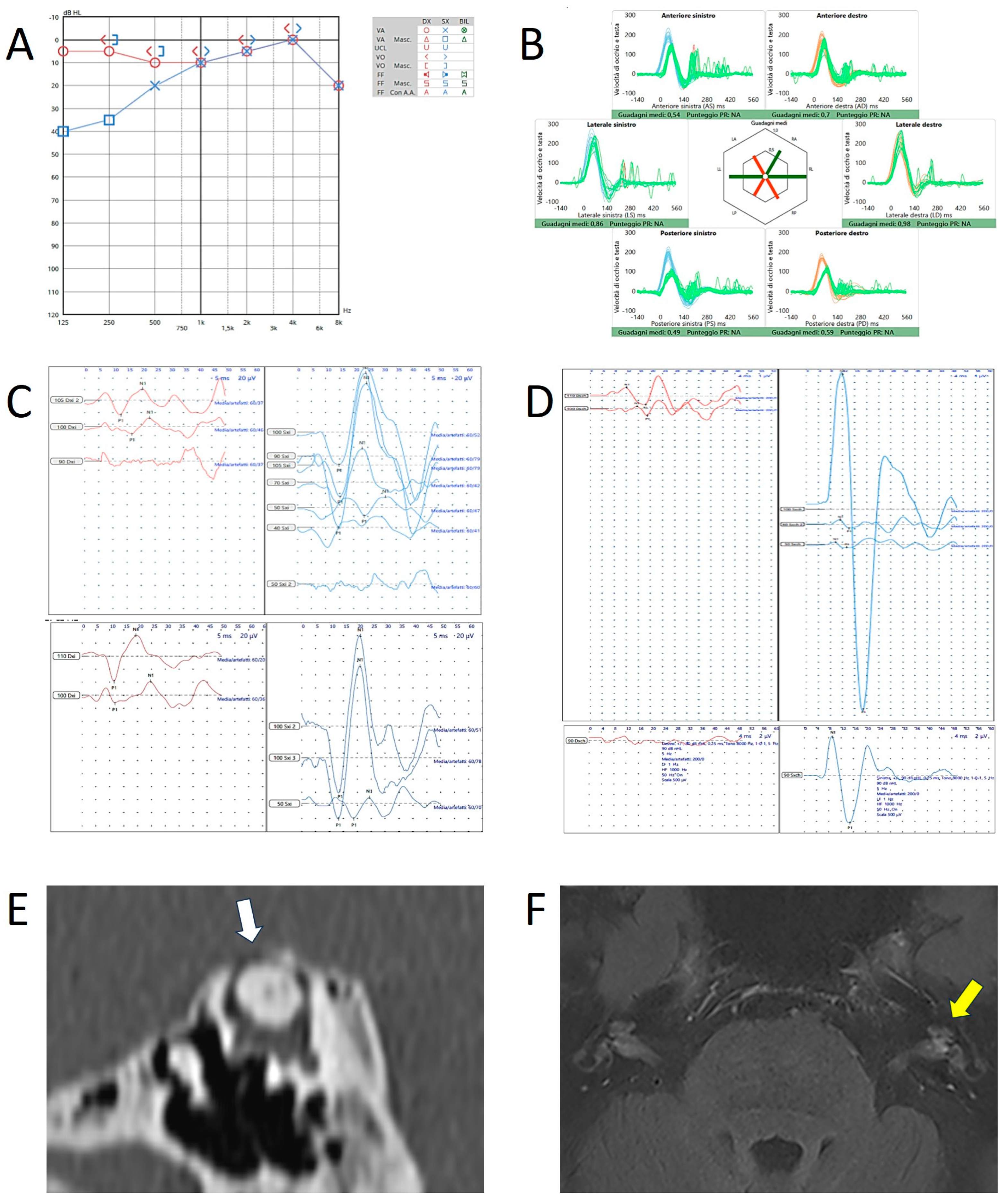Audiolres 15 00032 g003