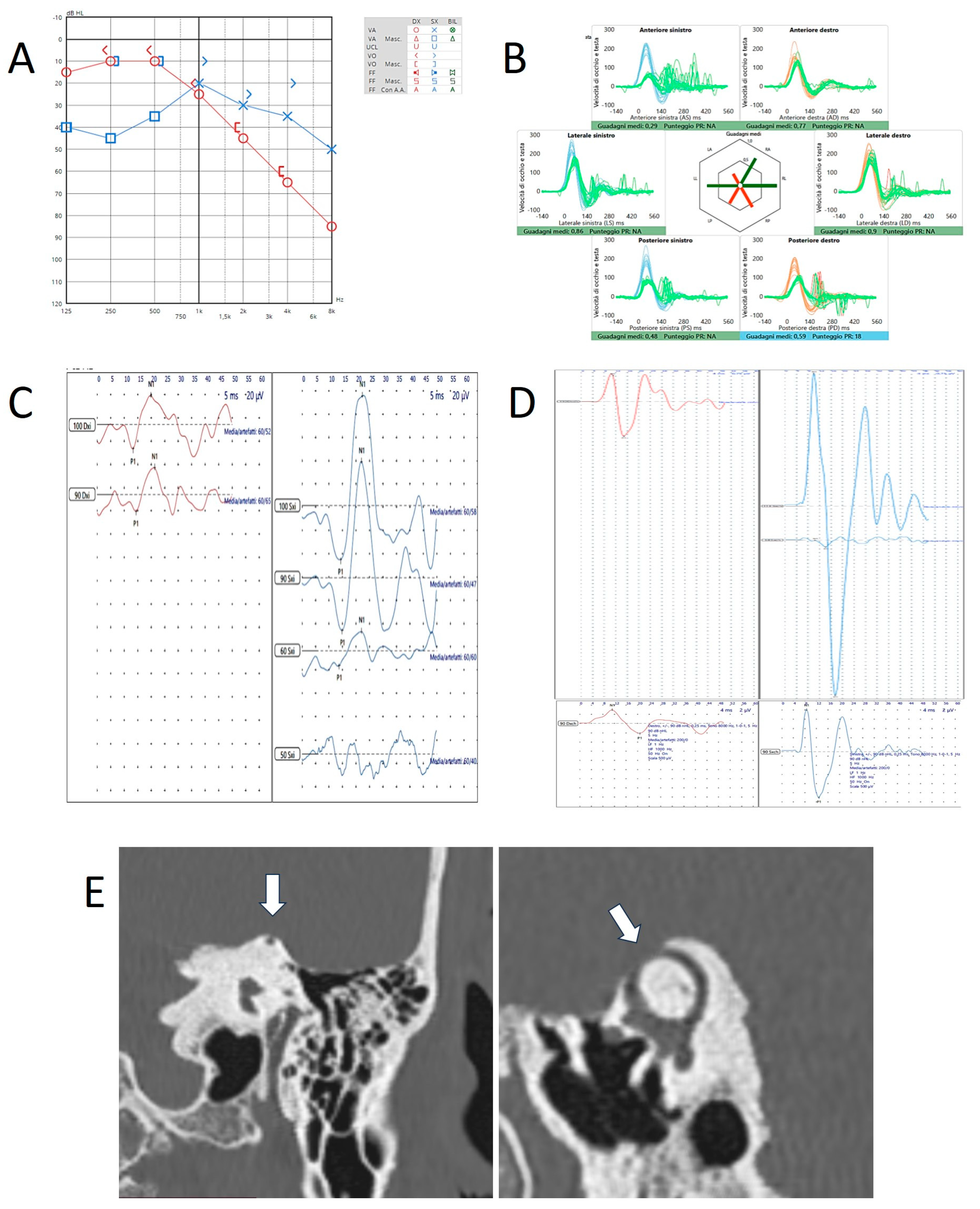 Audiolres 15 00032 g004