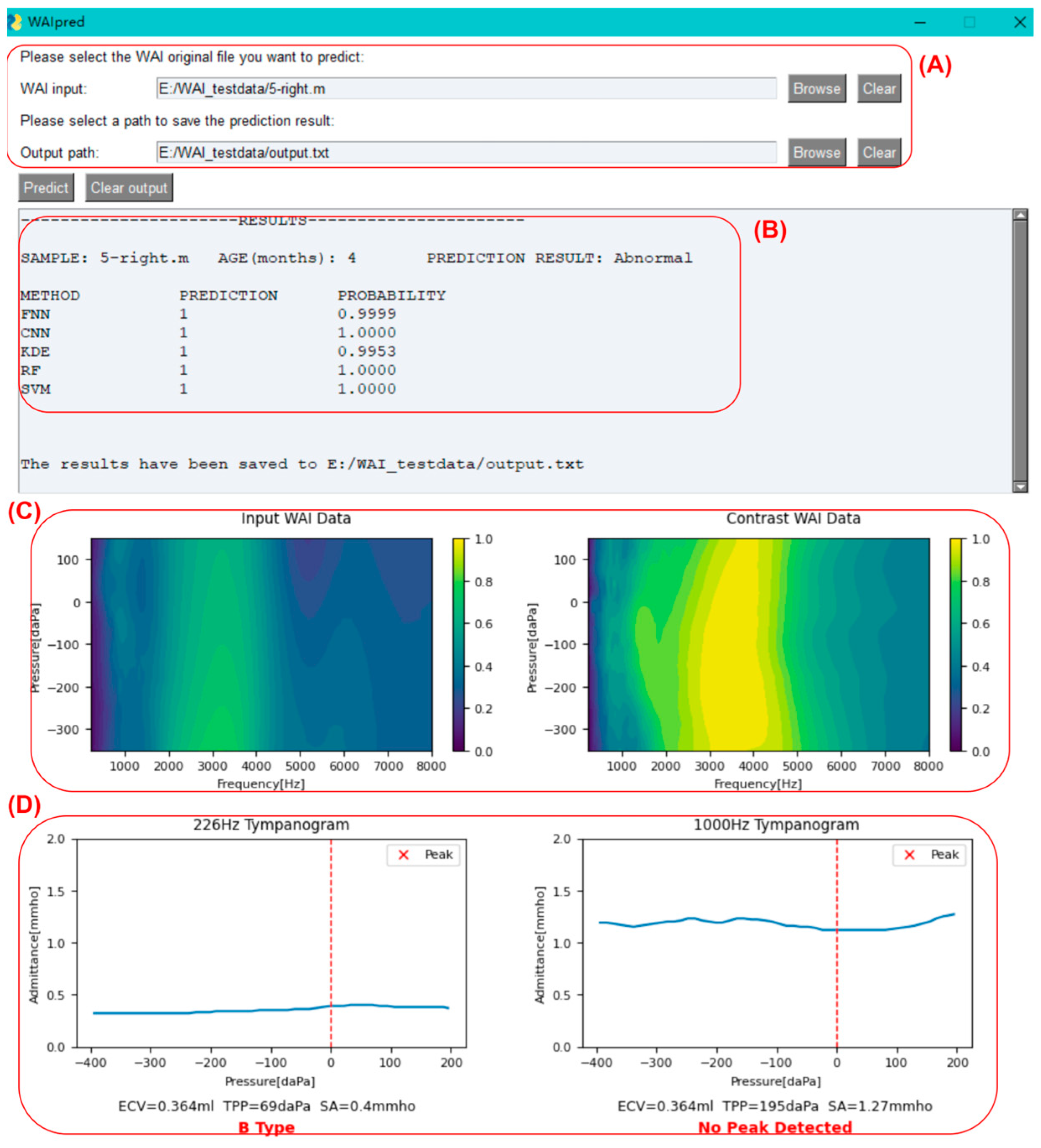 Audiolres 15 00035 g008
