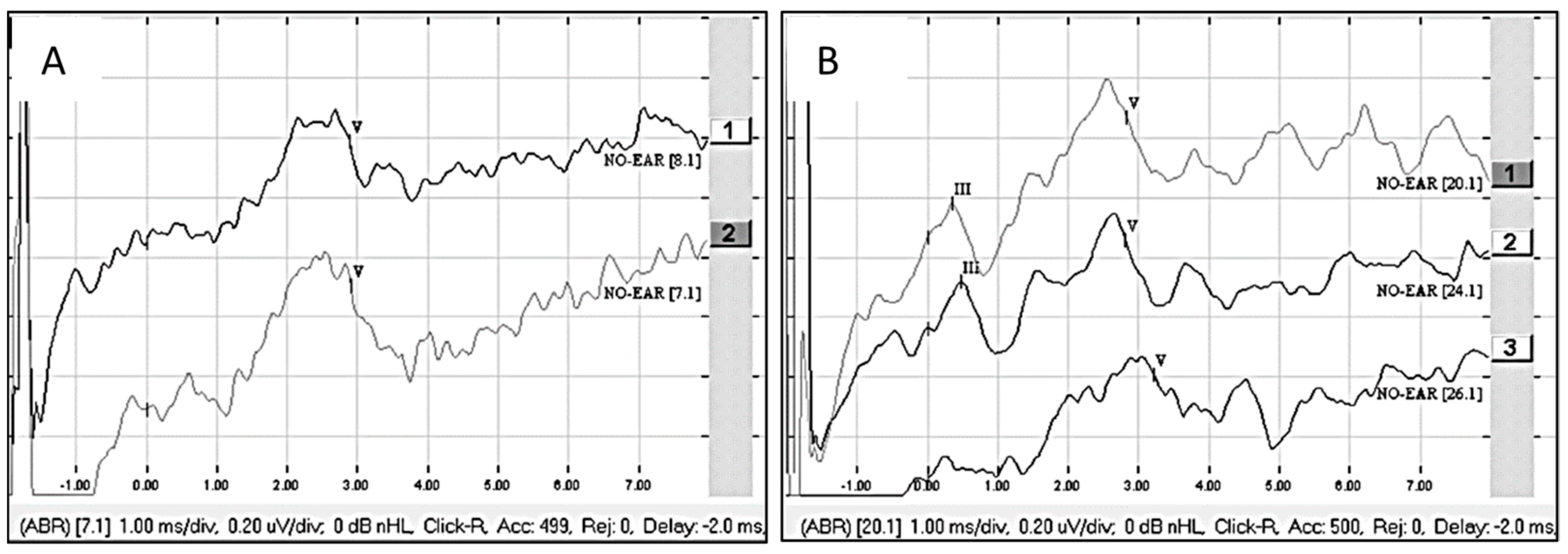 Audiolres 15 00036 g002