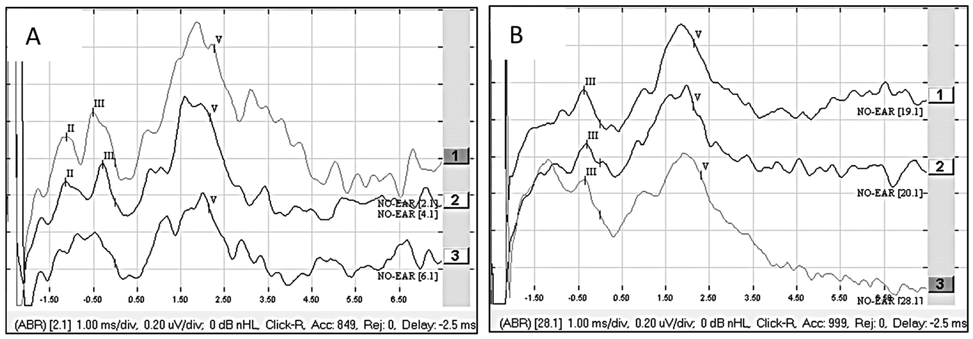 Audiolres 15 00036 g003