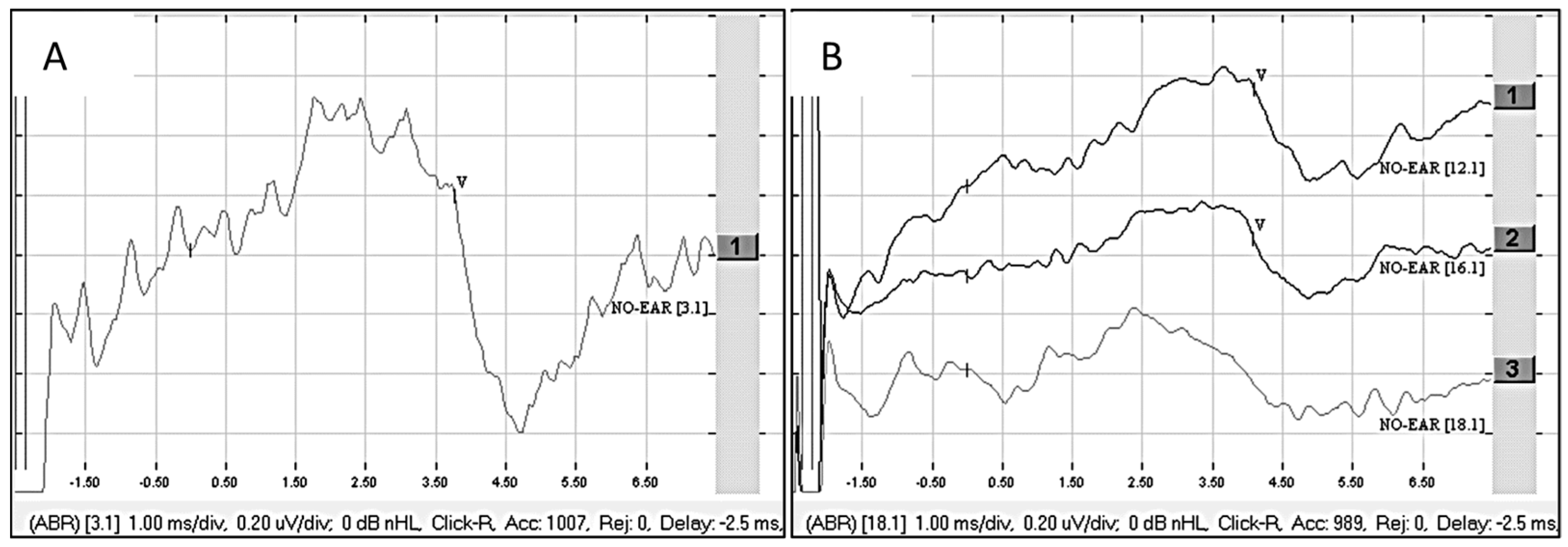Audiolres 15 00036 g004