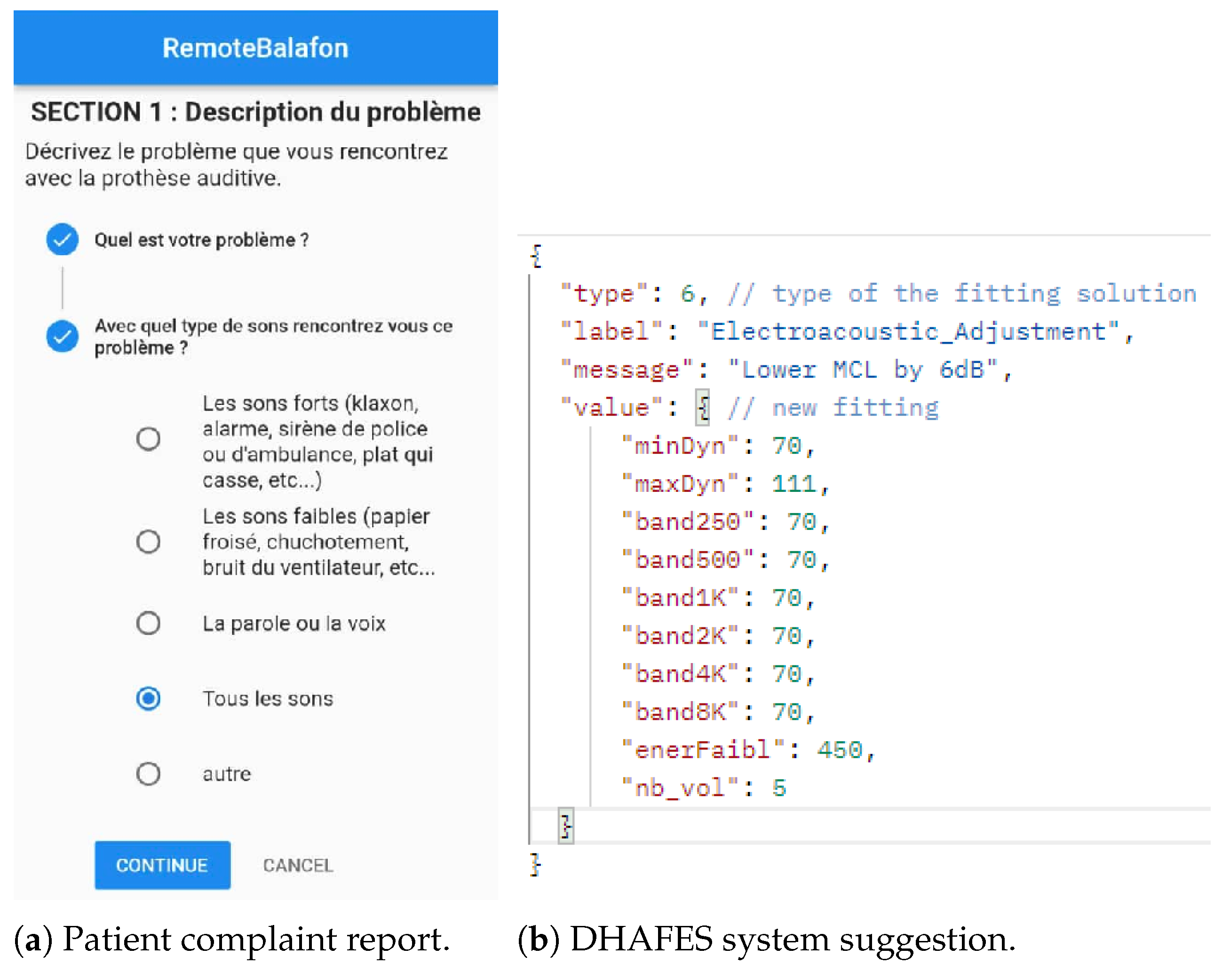 Audiolres 15 00039 g0a4