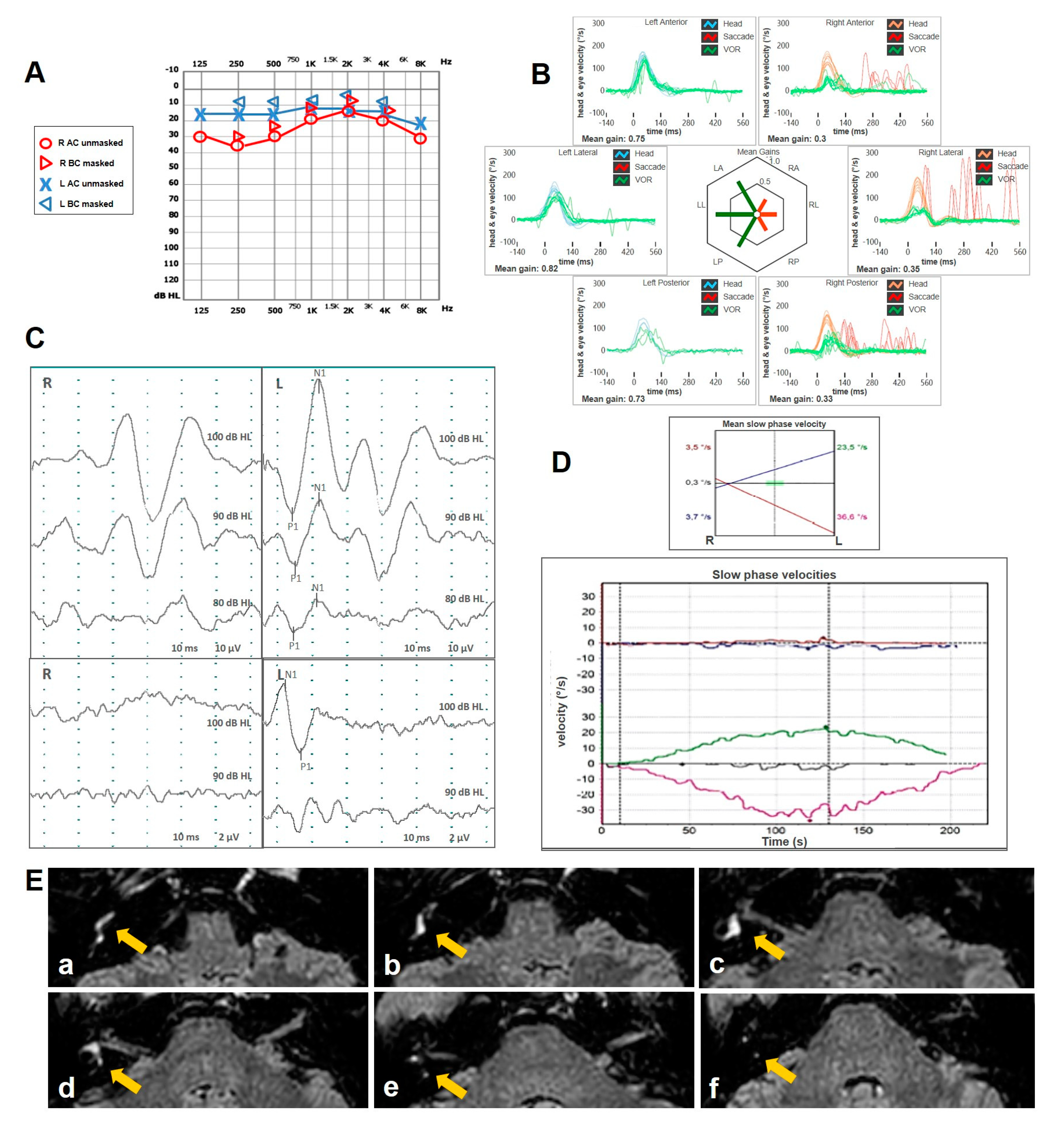 Audiolres 15 00061 g003