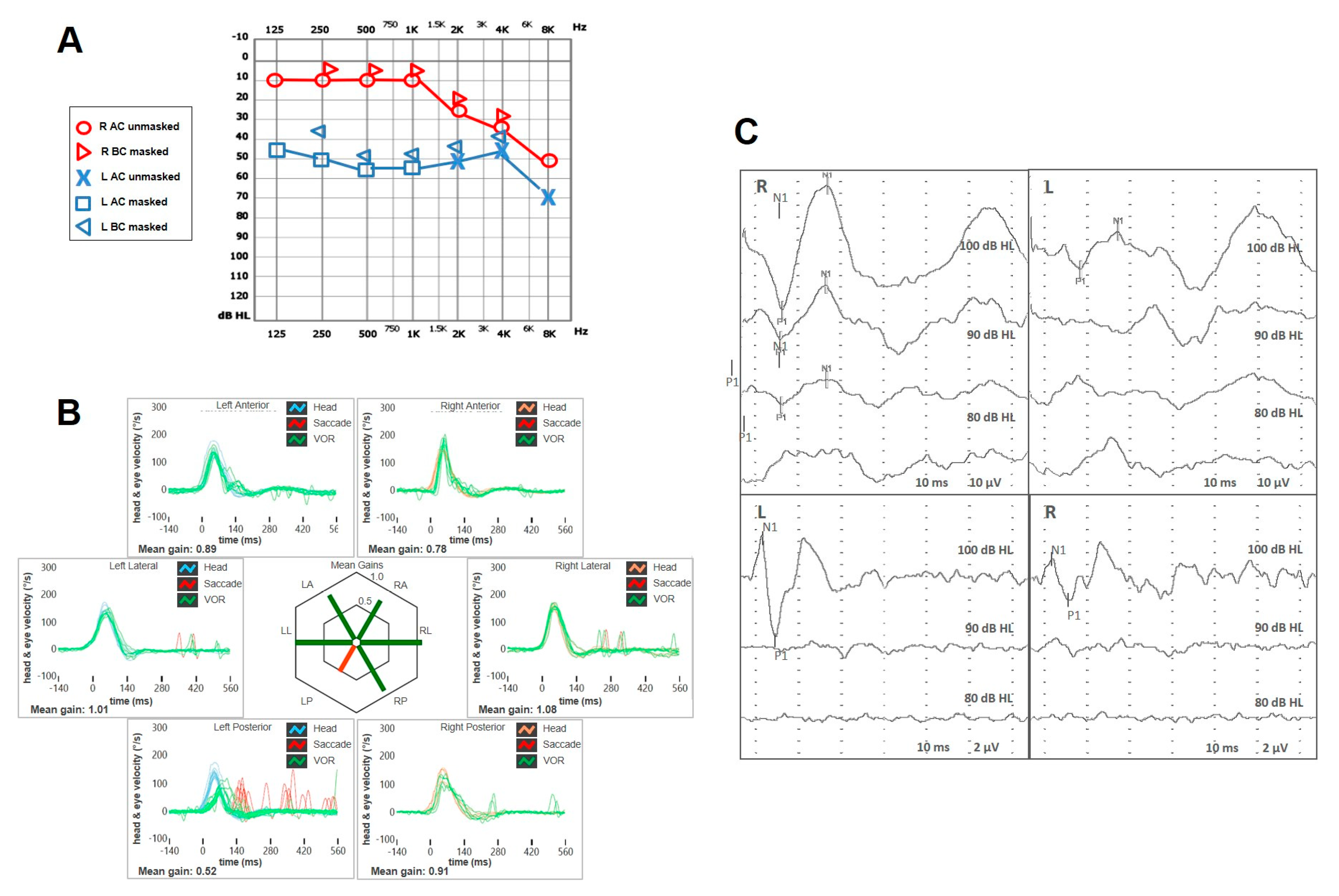Audiolres 15 00061 g004