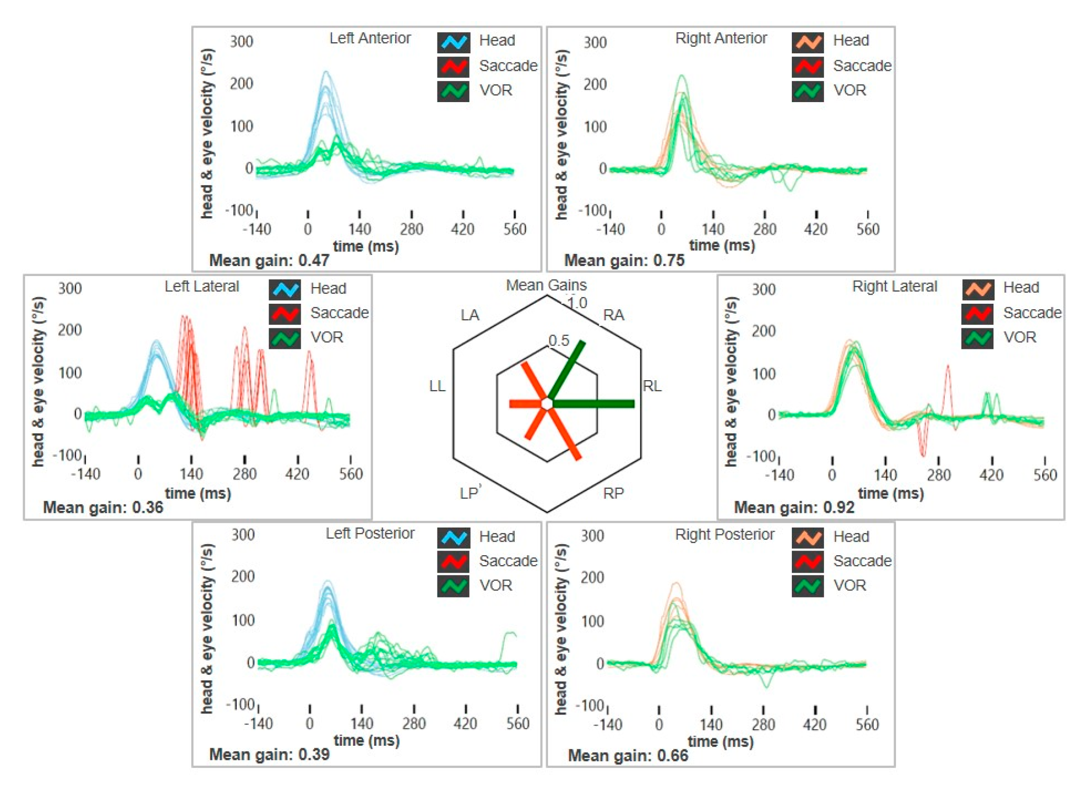 Audiolres 15 00061 g005