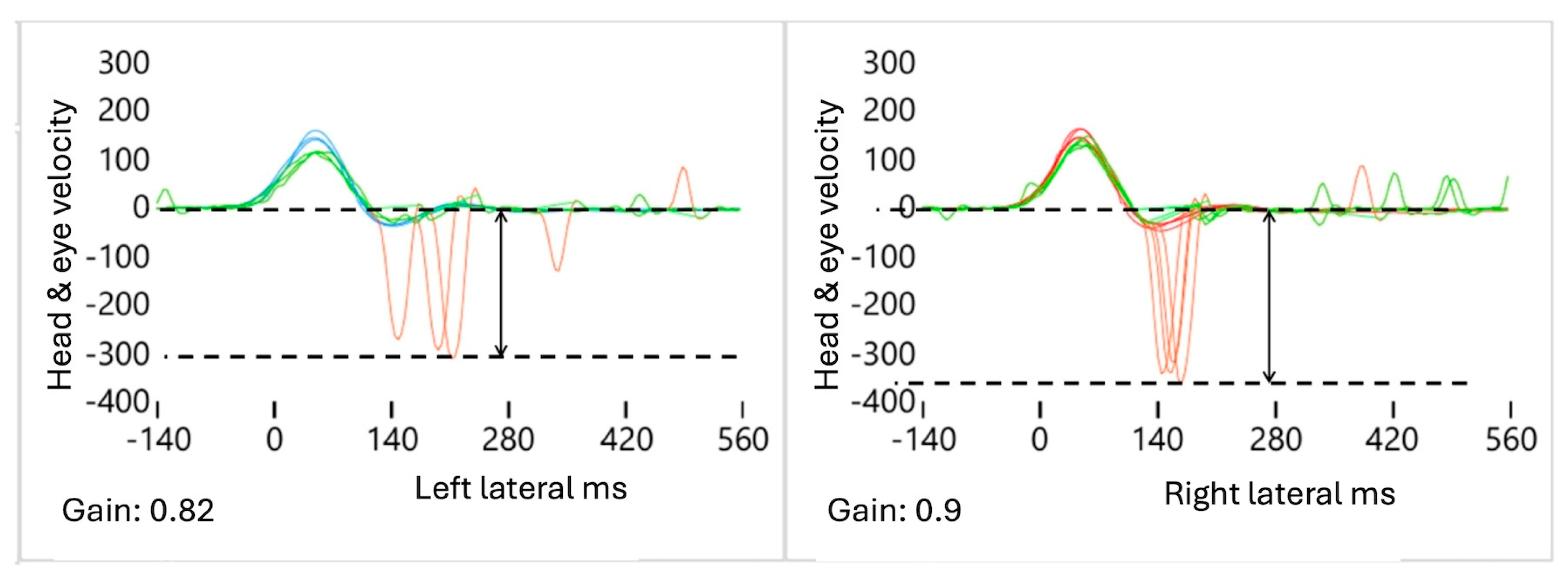 Audiolres 15 00110 g002 Audiolres 15 00110 g002