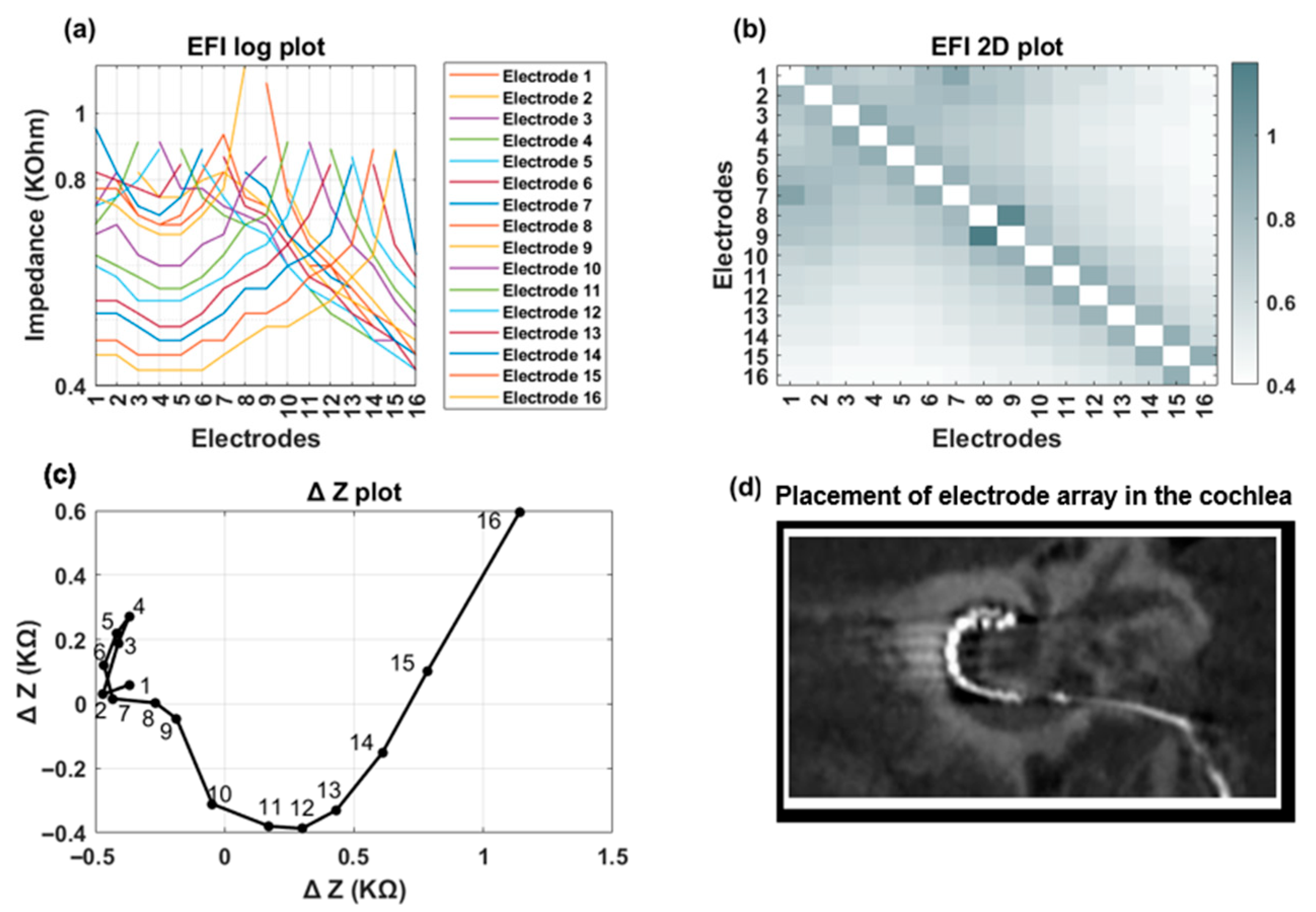 Audiolres 15 00118 g008