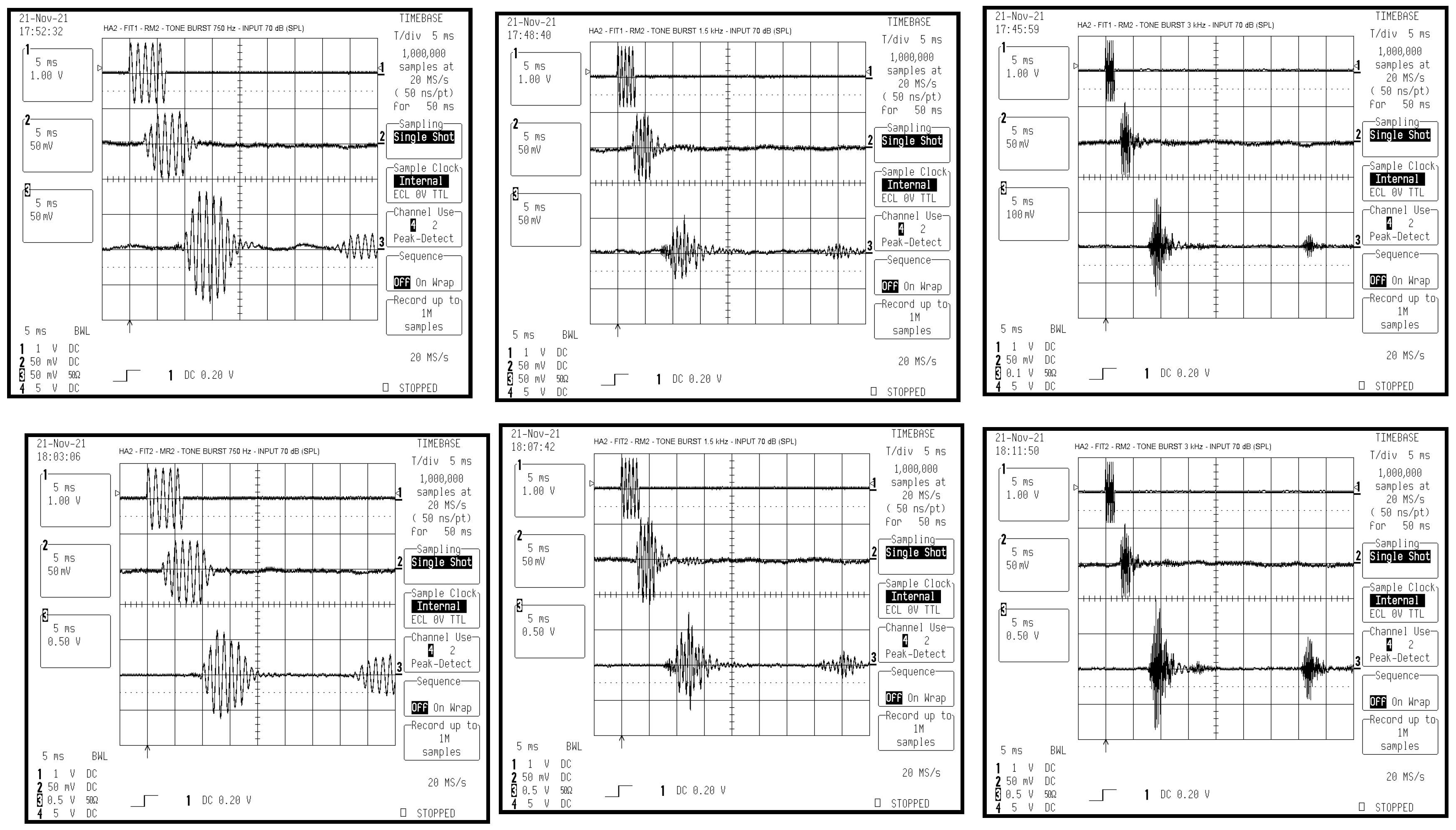 Audiolres 15 00123 g003