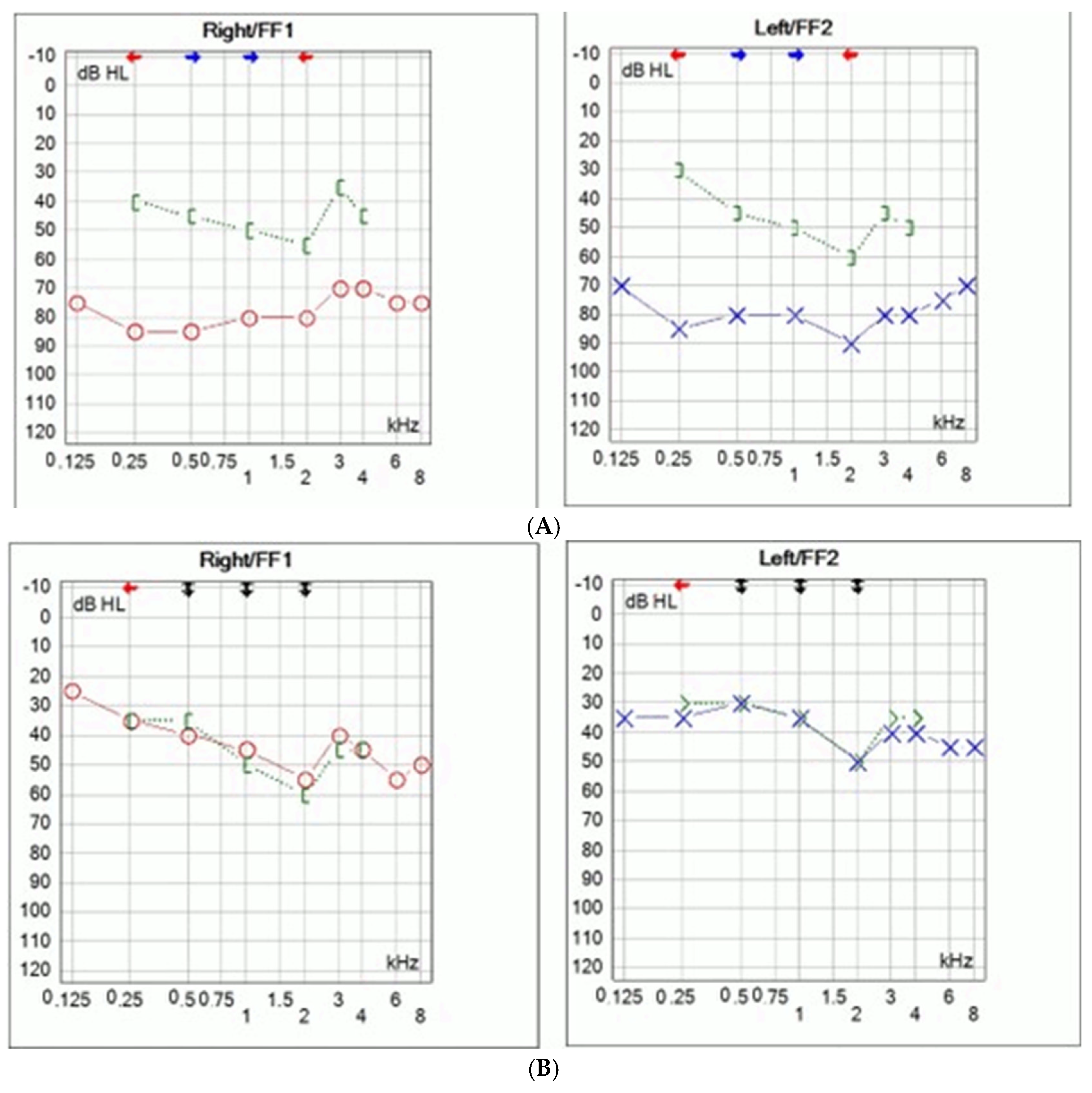 Audiolres 15 00130 g001