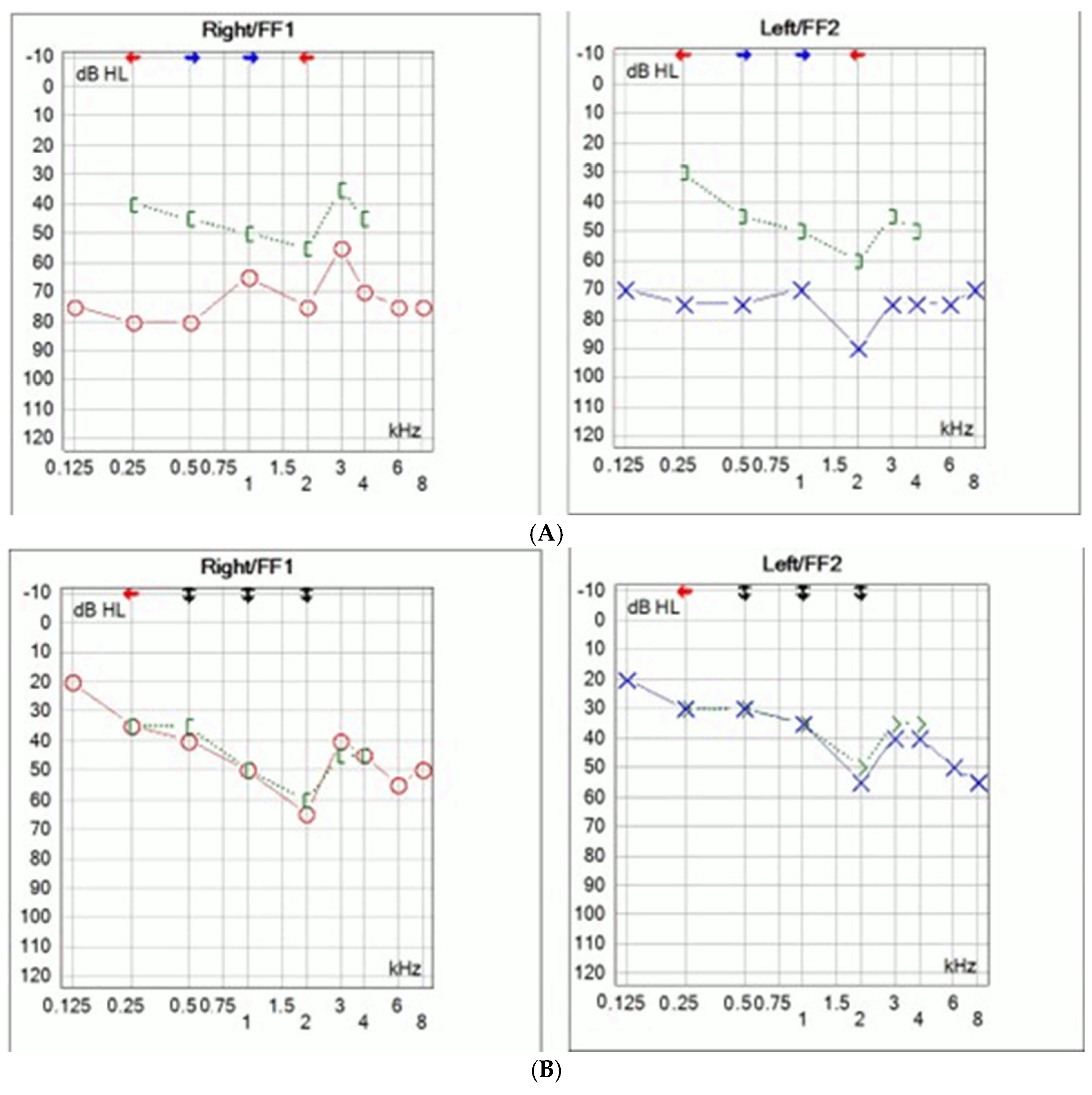 Audiolres 15 00130 g002