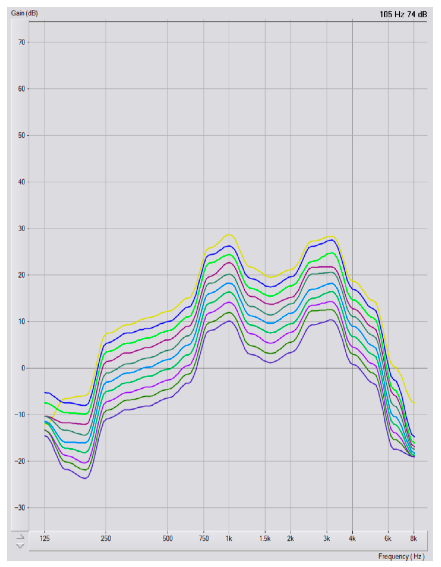 Audiolres 15 00137 g0a2