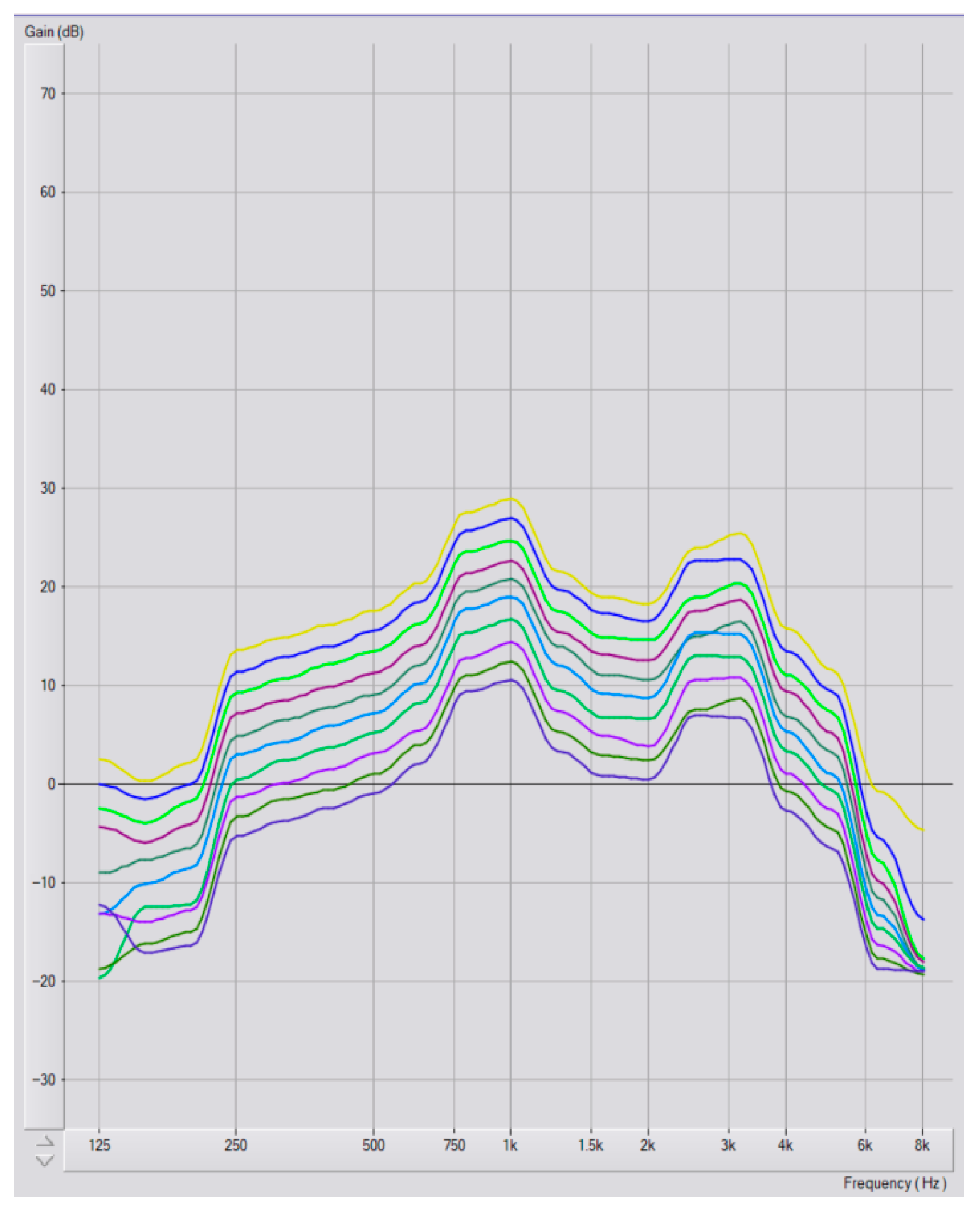 Audiolres 15 00137 g0a3