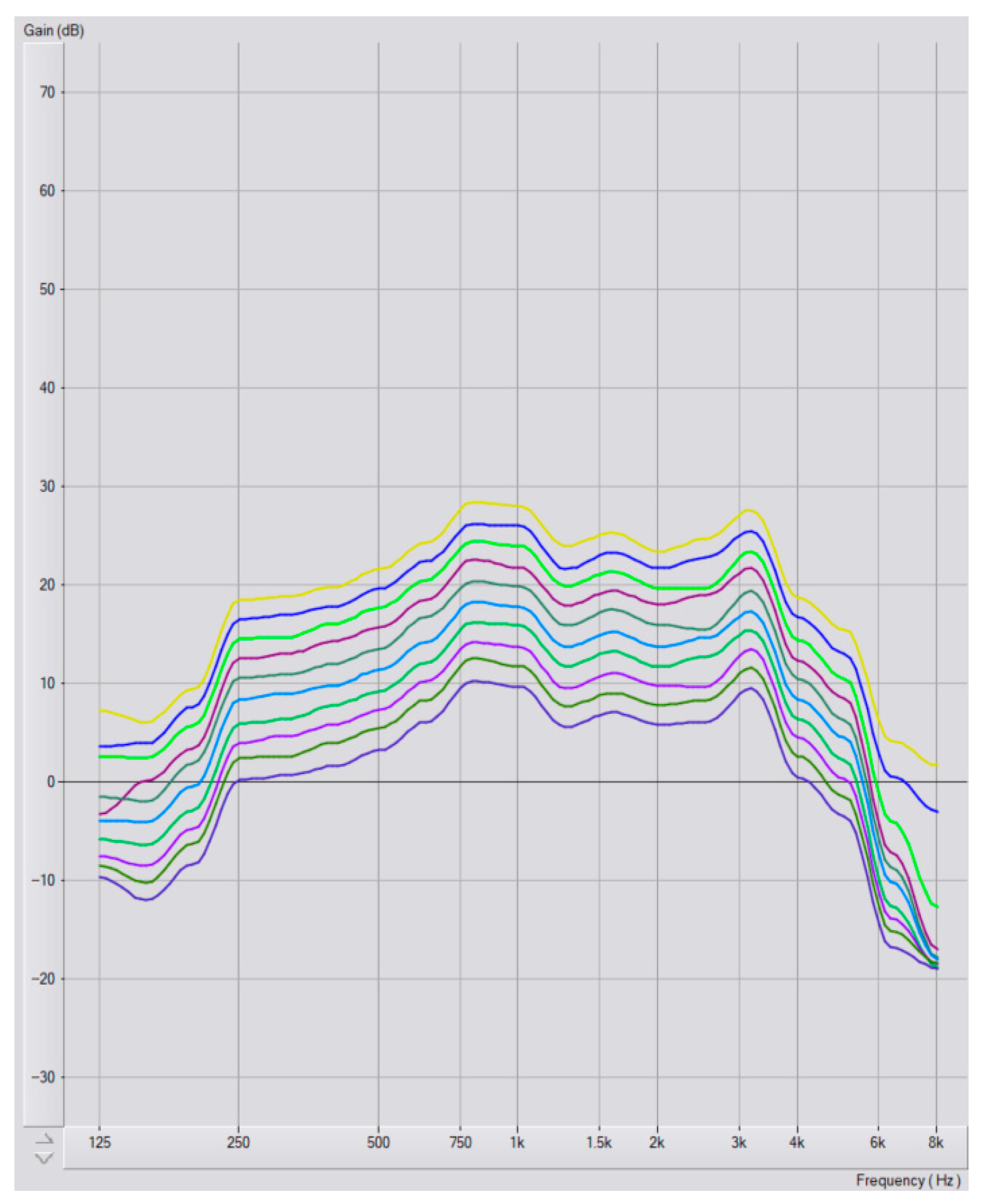 Audiolres 15 00137 g0a4