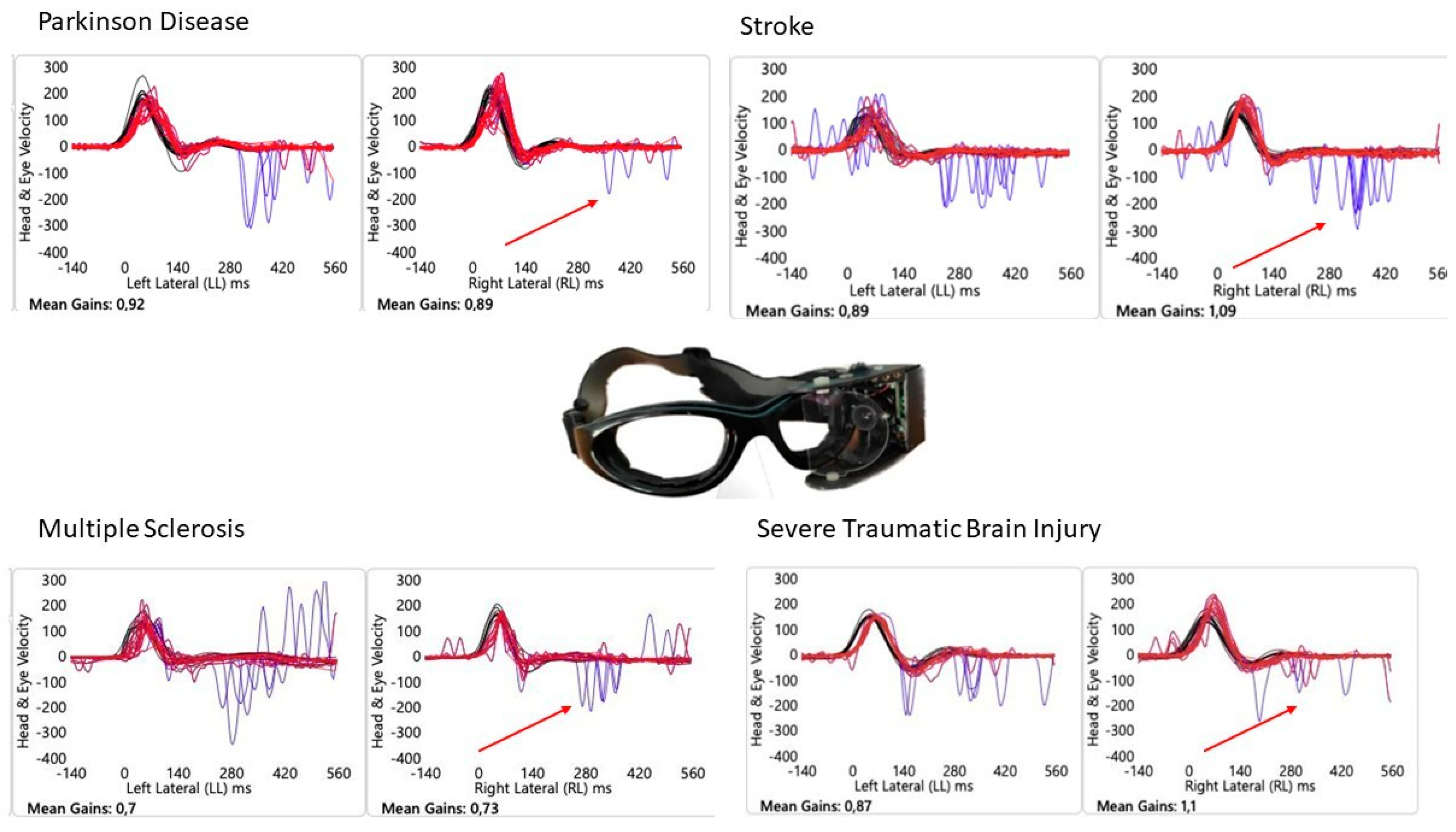 Audiolres 15 00154 g001