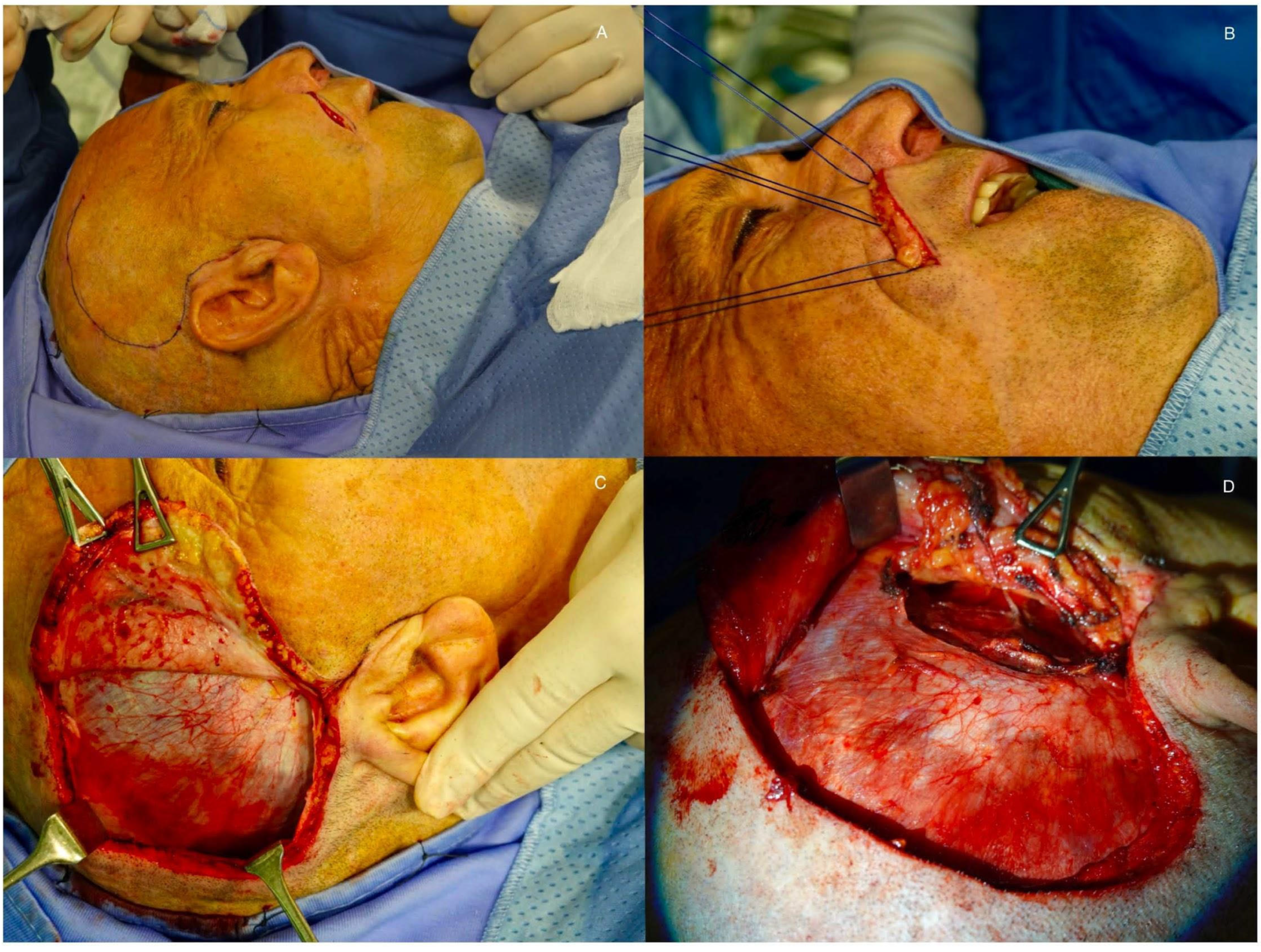 Audiolres 15 00155 g003