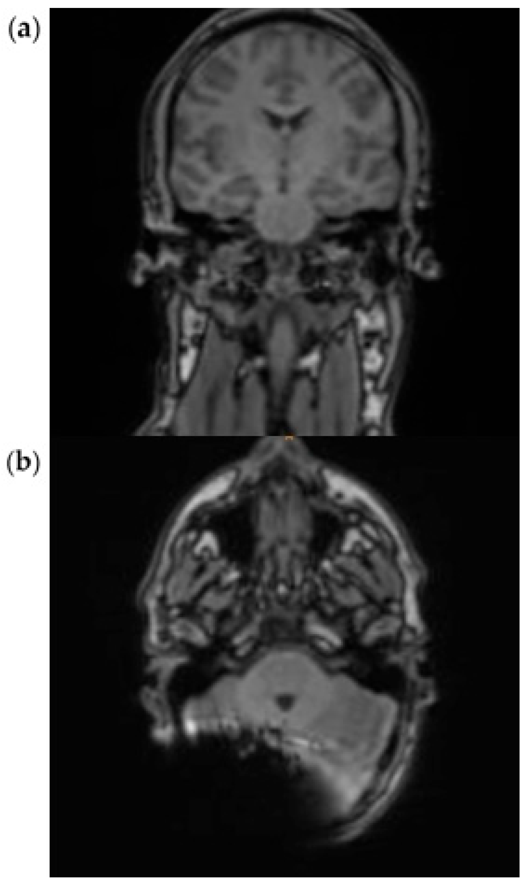 Audiolres 15 00162 g004