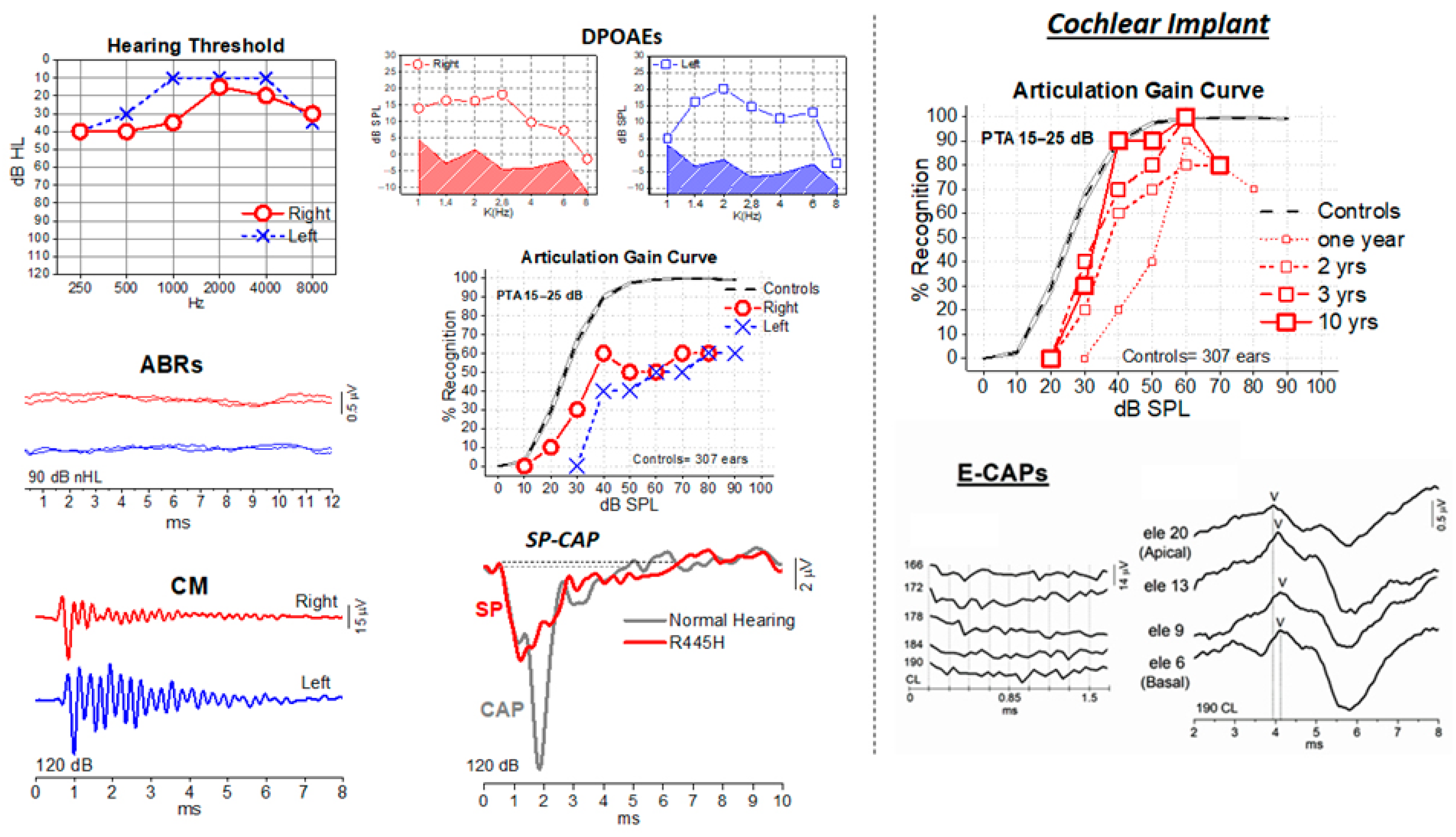 Audiolres 16 00005 g001