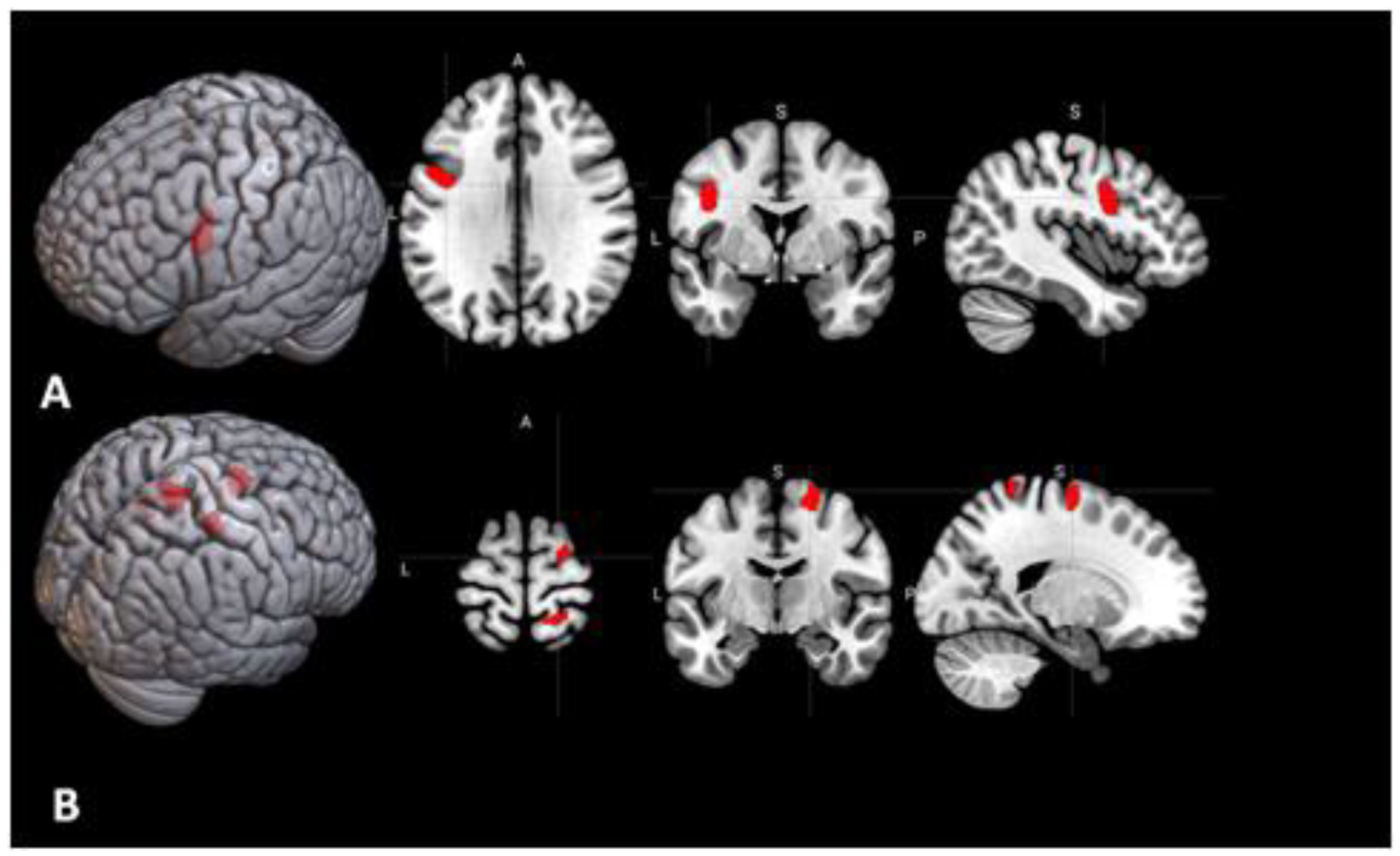 Behavioral Sciences Free Full Text Brain Activations And Functional Connectivity Patterns Associated With Insight Based And Analytical Anagram Solving Html Behavioral Sciences Free Full Text Brain Activations And Functional Connectivity Patterns Associated With Insight Based And Analytical Anagram Solving Html