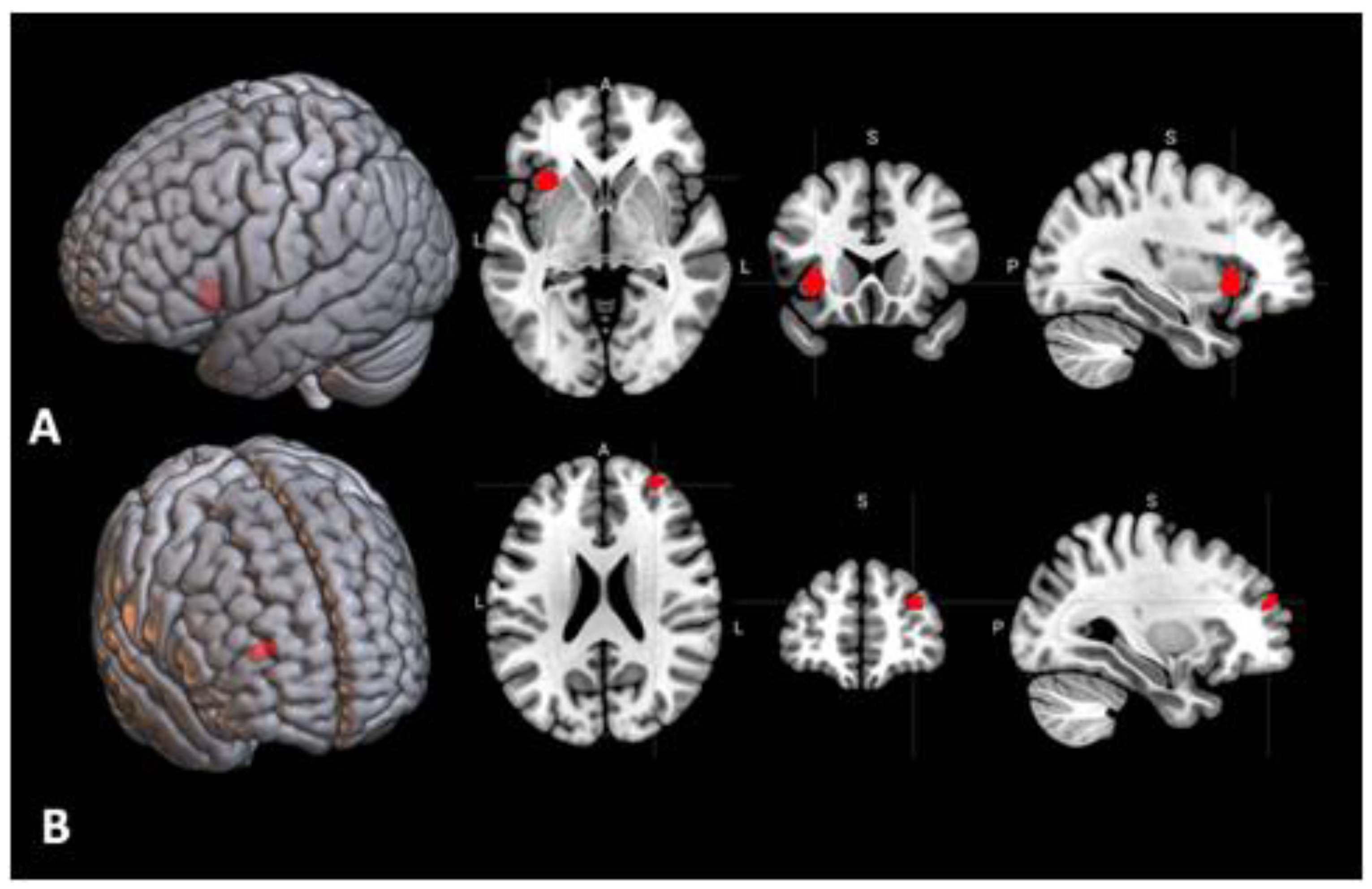 Behavioral Sciences Free Full Text Brain Activations And Functional Connectivity Patterns Associated With Insight Based And Analytical Anagram Solving Html Behavioral Sciences Free Full Text Brain Activations And Functional Connectivity Patterns Associated With Insight Based And Analytical Anagram Solving Html