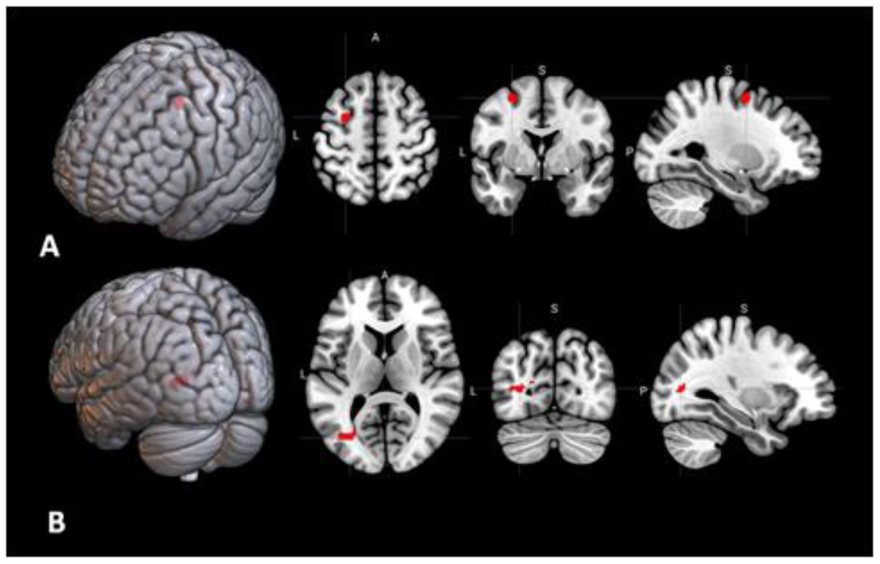 Behavioral Sciences Free Full Text Brain Activations And Functional Connectivity Patterns Associated With Insight Based And Analytical Anagram Solving Html Behavioral Sciences Free Full Text Brain Activations And Functional Connectivity Patterns Associated With Insight Based And Analytical Anagram Solving Html