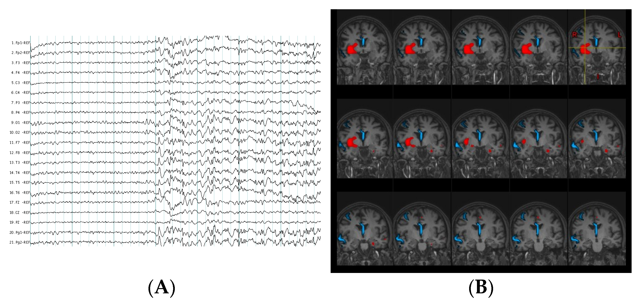 Behavsci 11 00030 g001 Behavsci 11 00030 g001