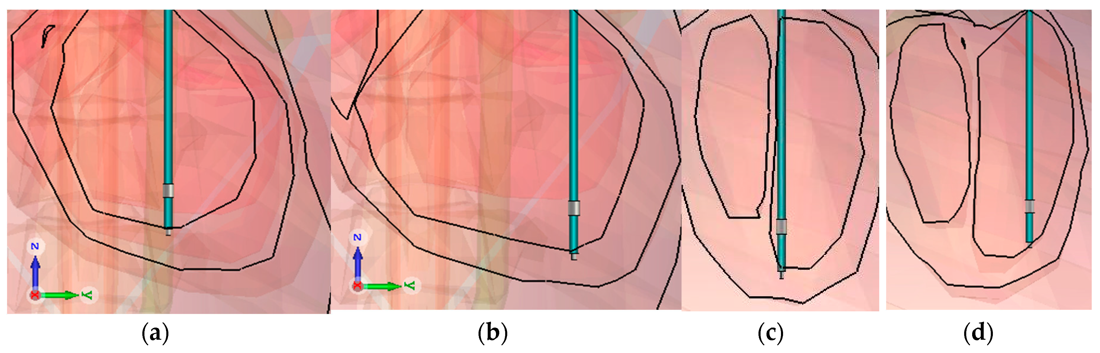 Bioengineering 04 00019 g005 550