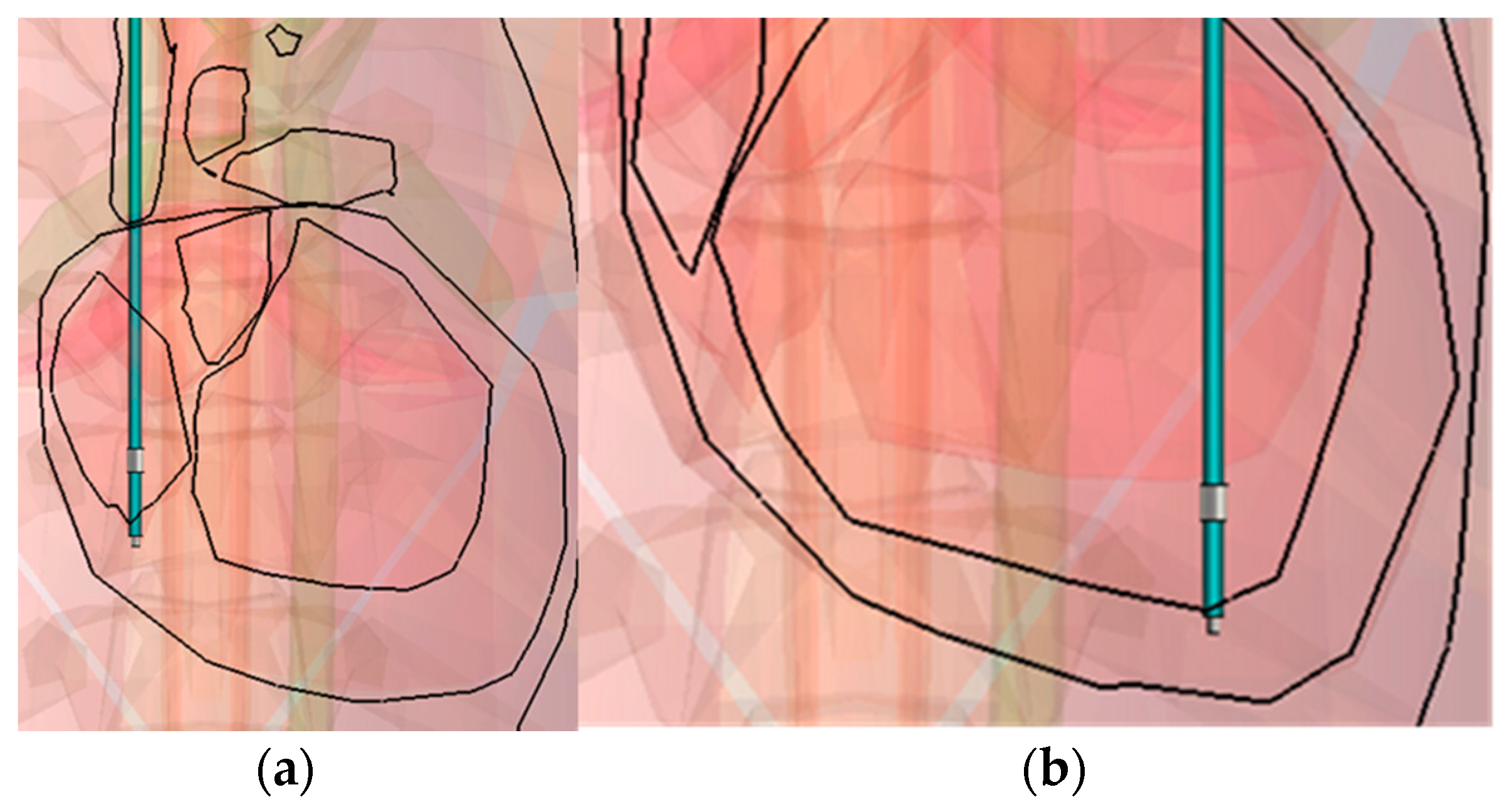 Bioengineering 04 00019 g006 550