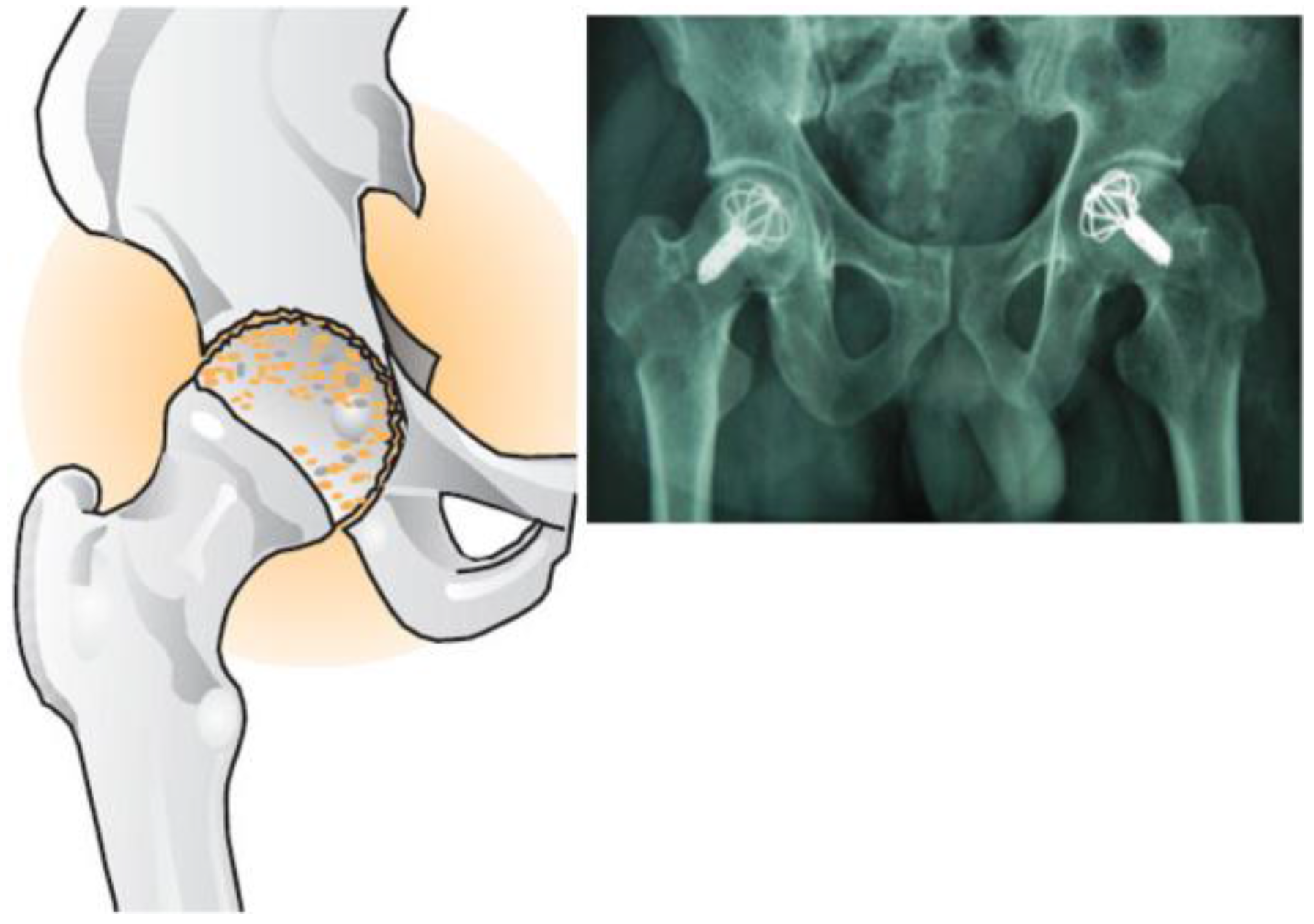 Bioengineering 04 00023 g001