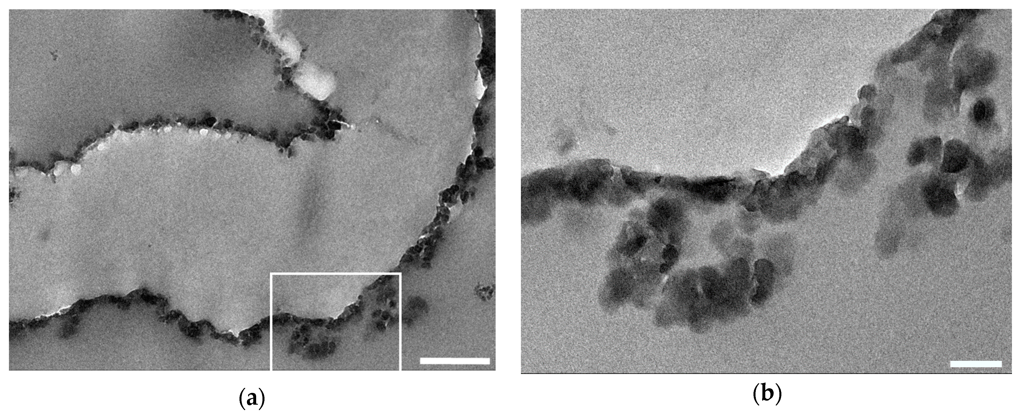 Bioengineering 05 00014 g006