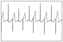 Bioengineering 05 00035 i006