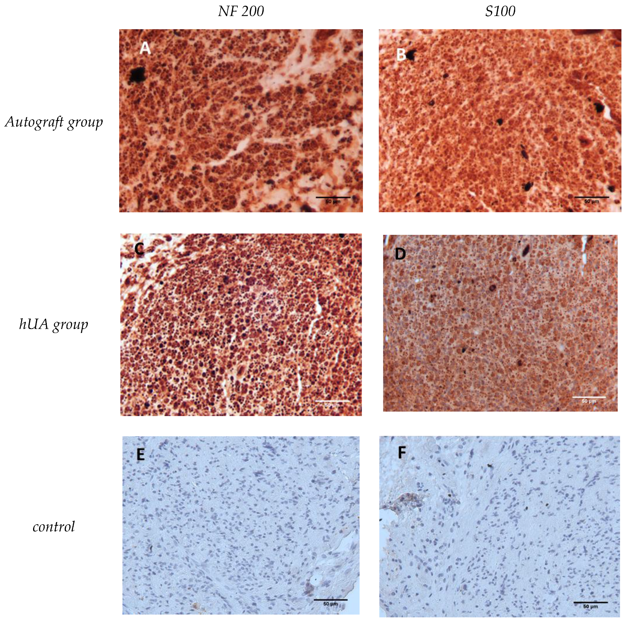 Bioengineering 05 00100 g005