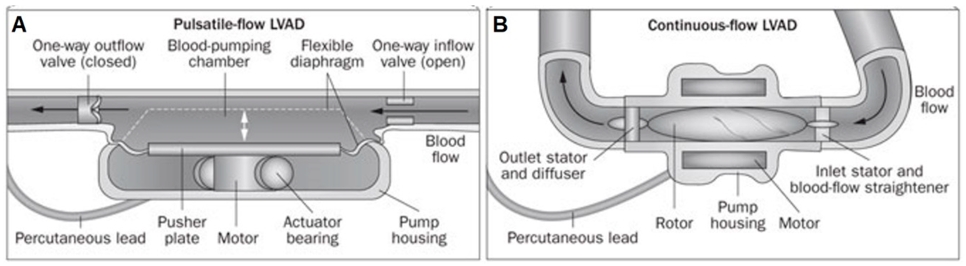 Bioengineering | Full-Text | Cardiac Devices: Early Concepts, Current Technologies, and Future Innovations |