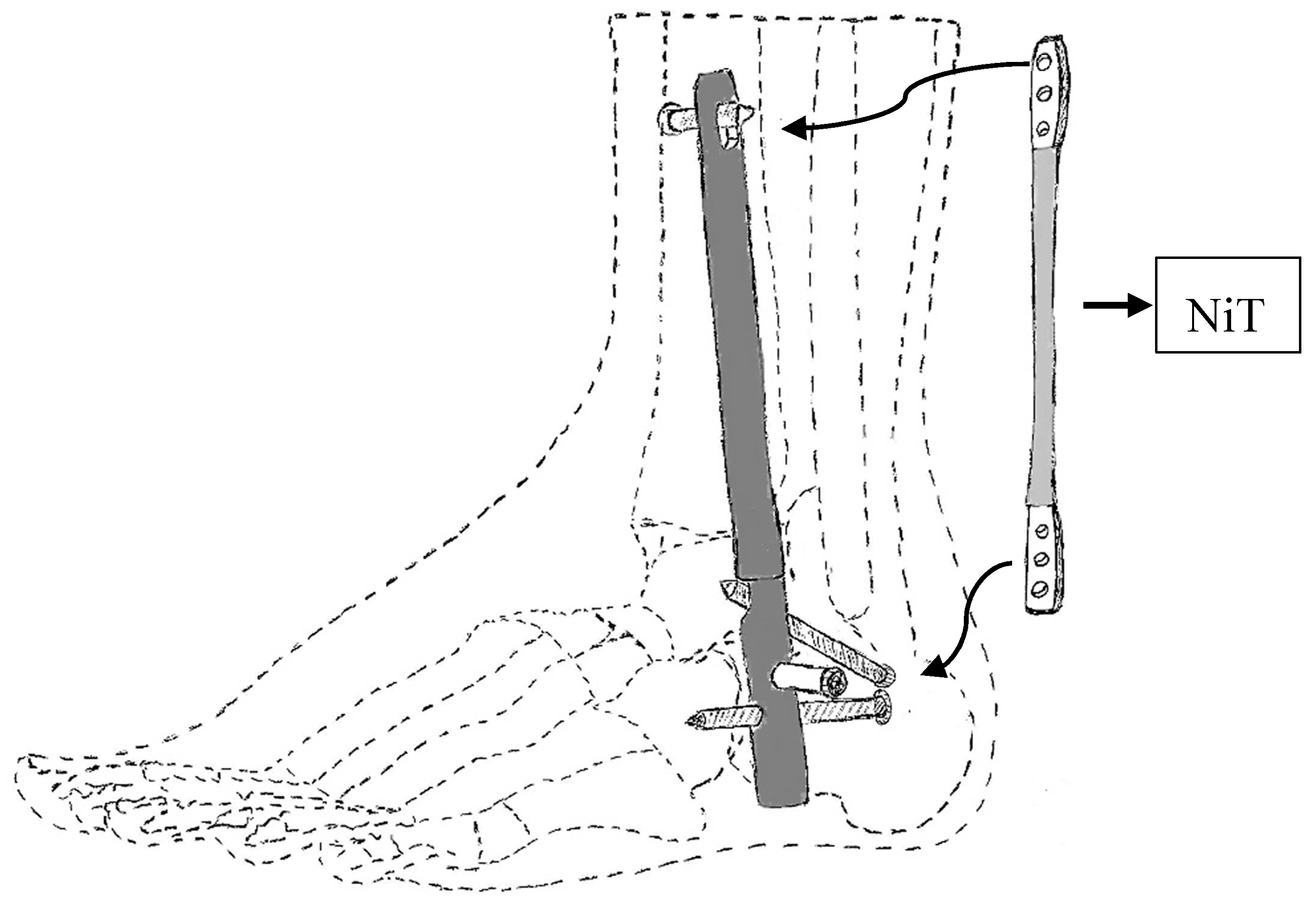 Bioengineering 06 00037 g030 Bioengineering 06 00037 g030