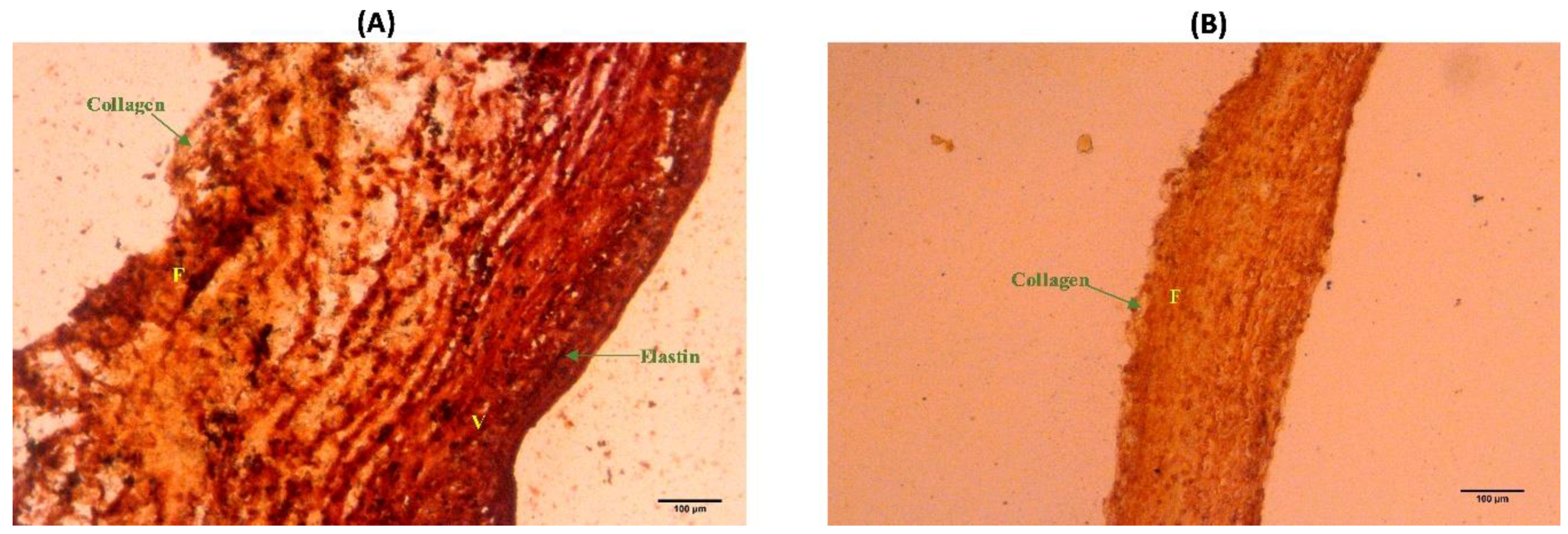 Bioengineering 06 00039 g005