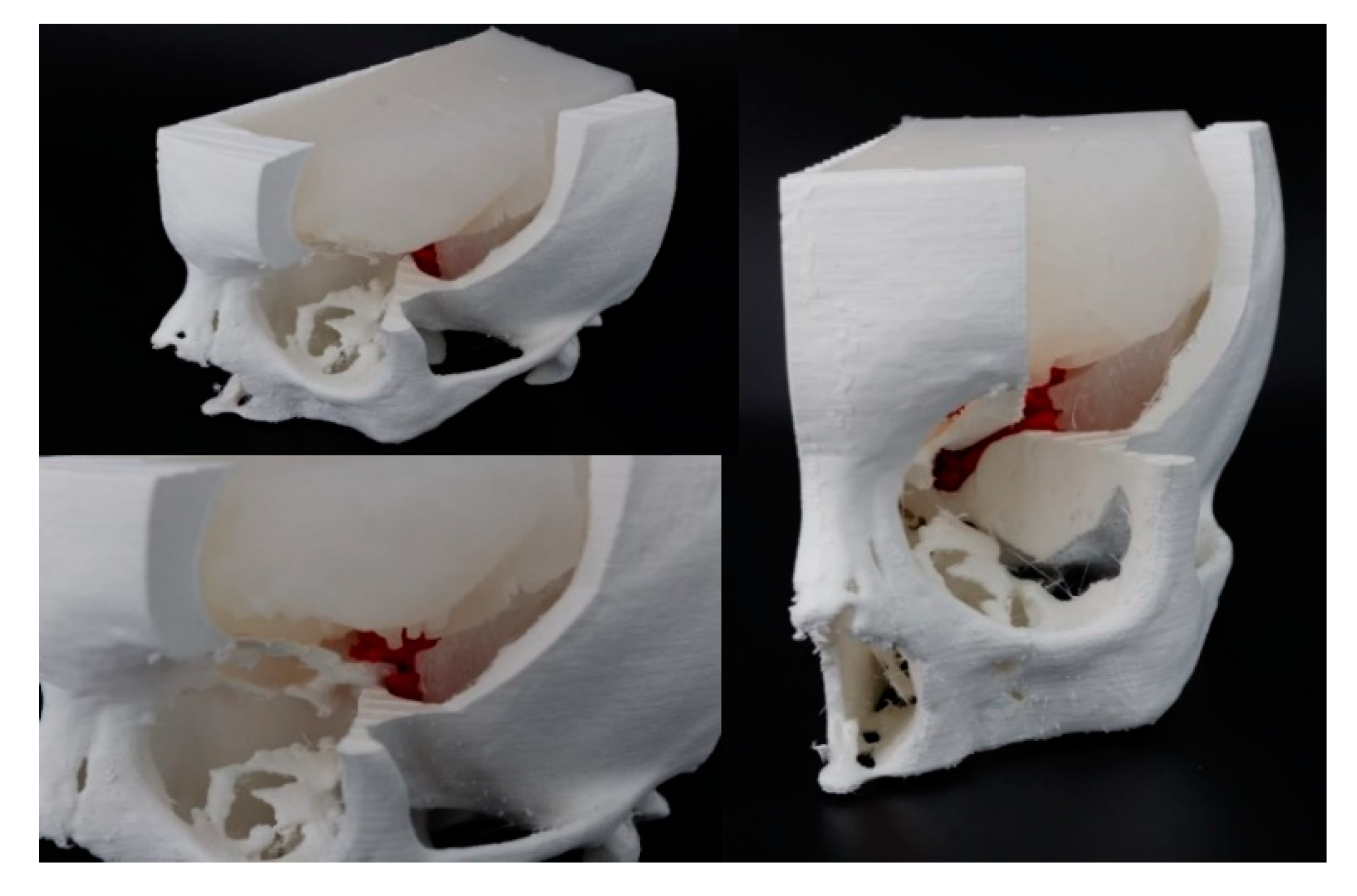 Bioengineering 07 00007 g005