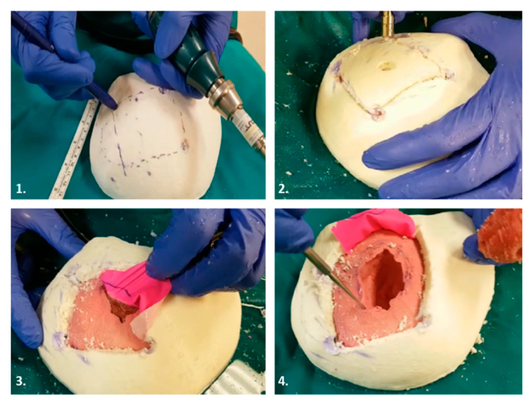 Bioengineering 07 00007 g006