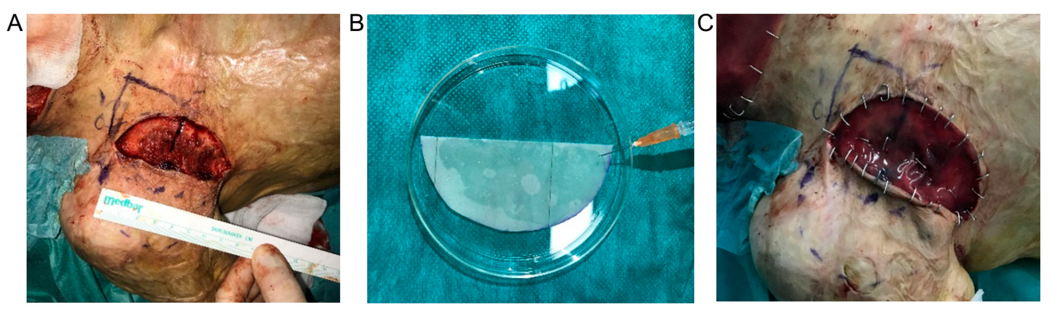 Bioengineering 07 00067 g005