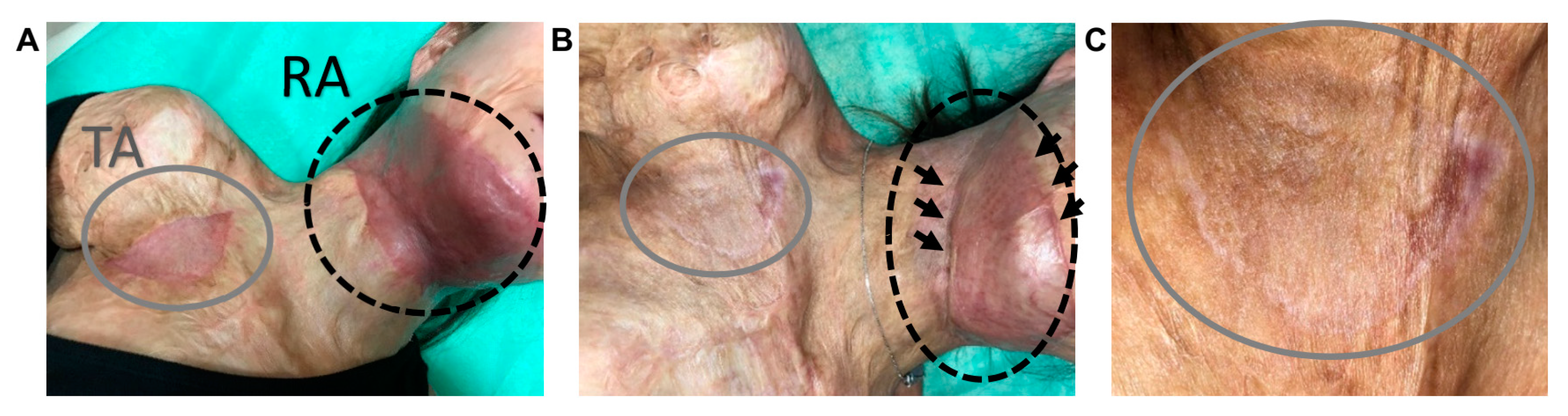 Bioengineering 07 00067 g006
