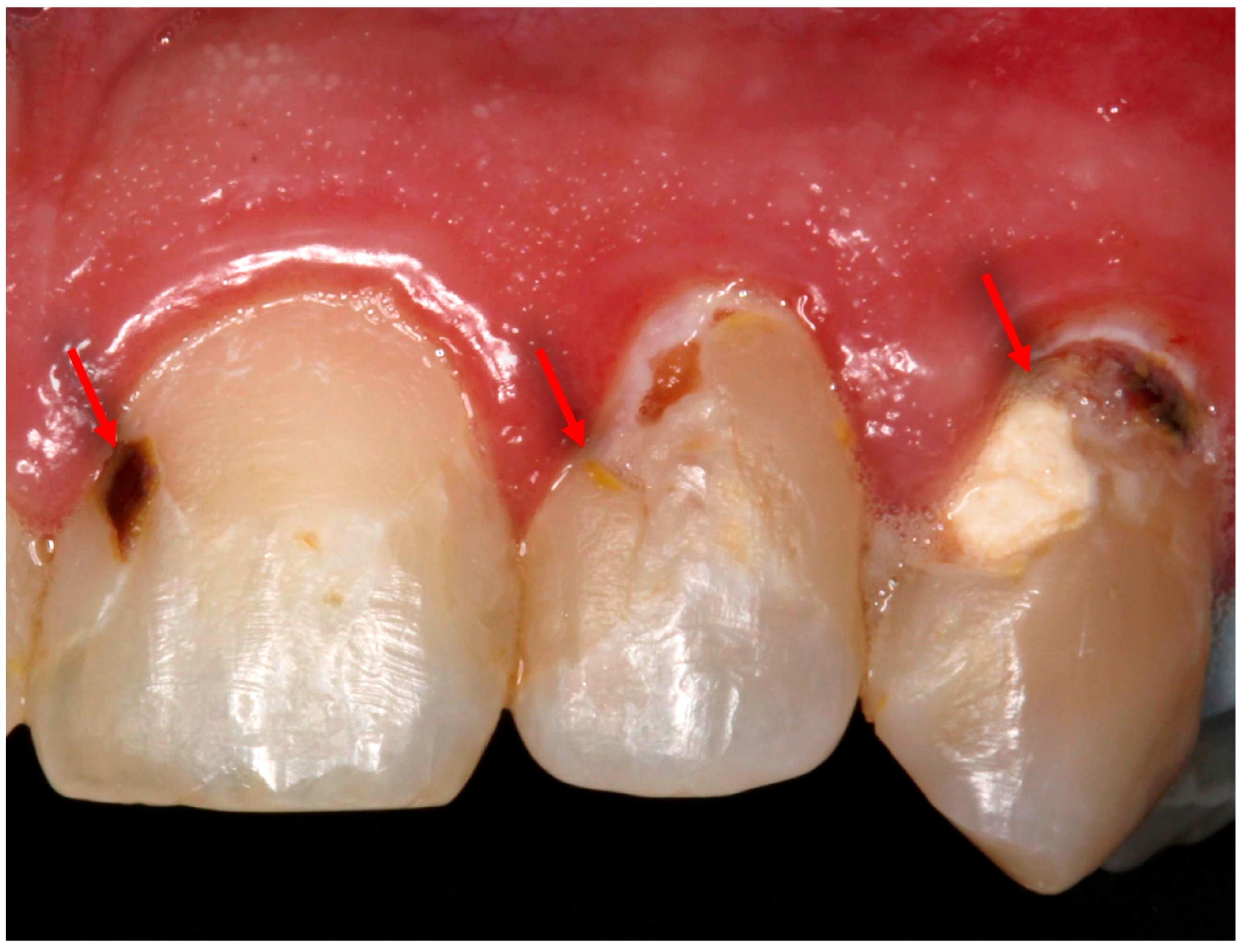 Bioengineering 07 00083 g001