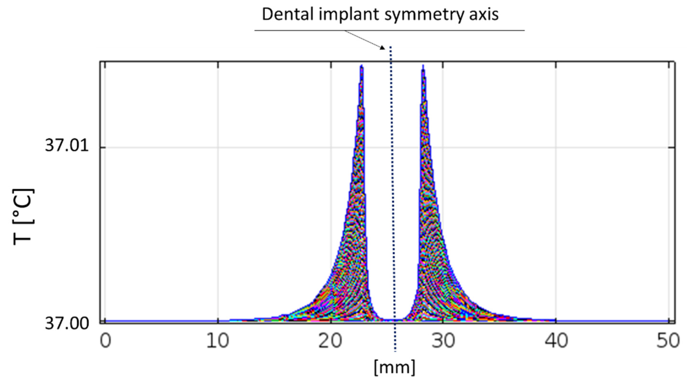 Bioengineering Free Full Text Development Of A Novel Medical Device For Mucositis And Peri Implantitis Treatment Html