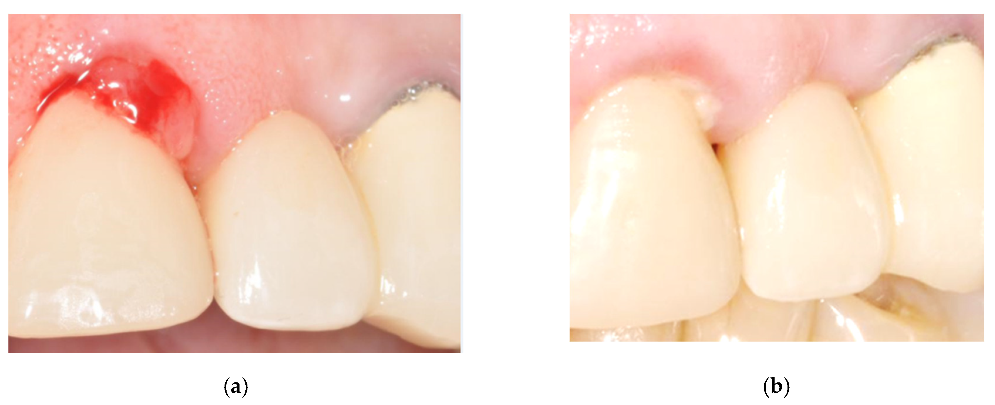 Bioengineering 07 00087 g016