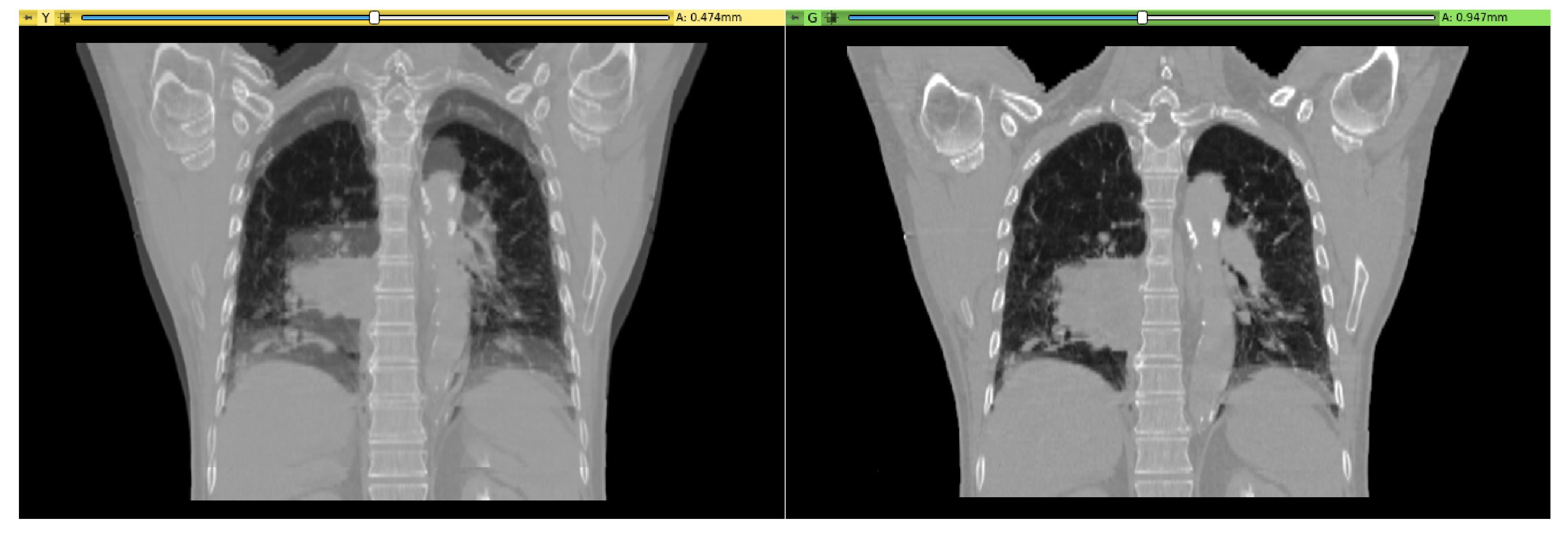 Bioengineering 07 00109 g005
