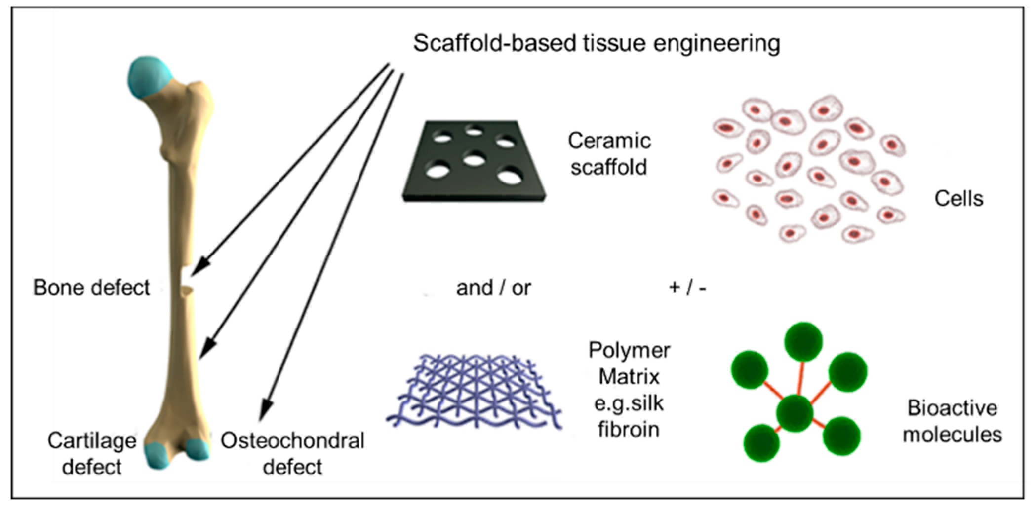 Perspectives on Synthetic Materials to Guide Tissue Regeneration for  Osteochondral Defect Repair