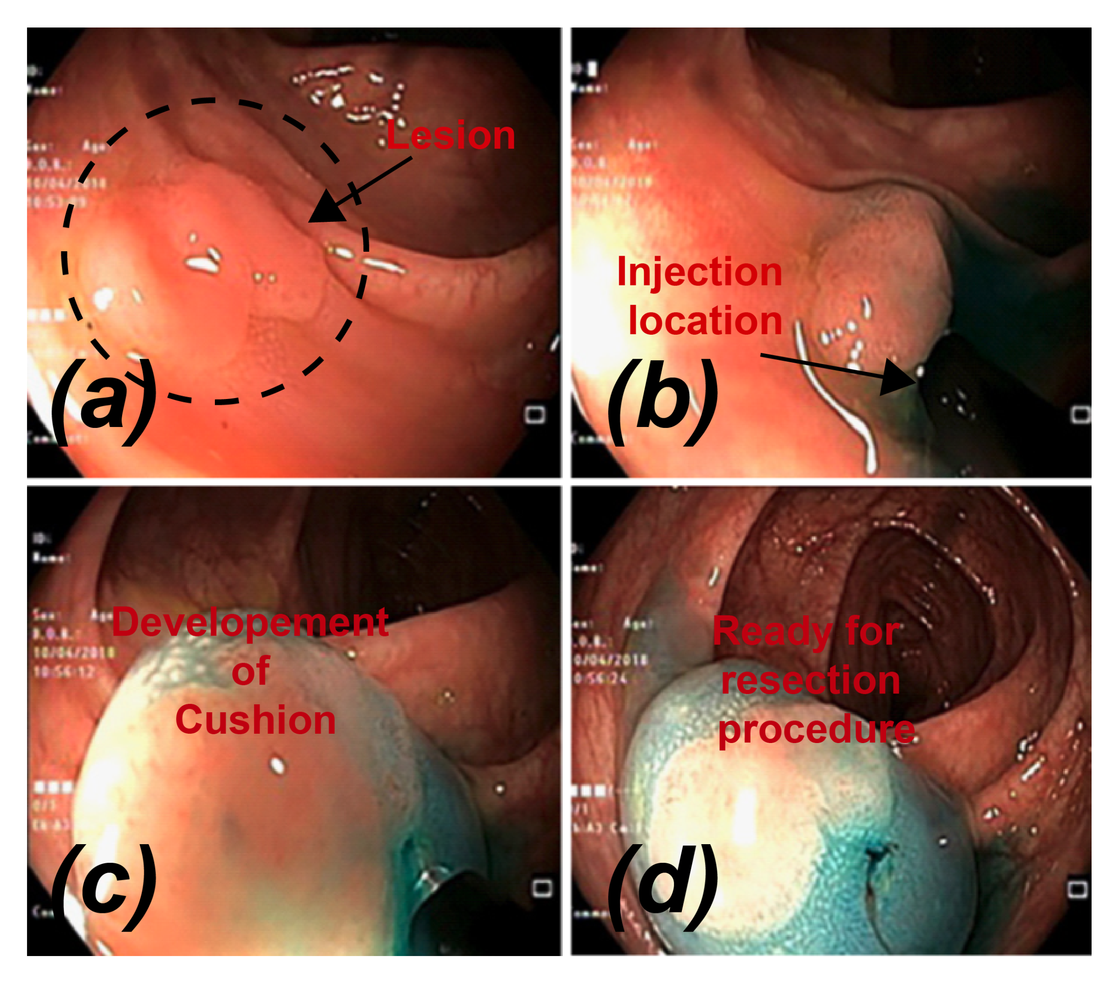 Bioengineering 07 00136 g001 Bioengineering 07 00136 g001