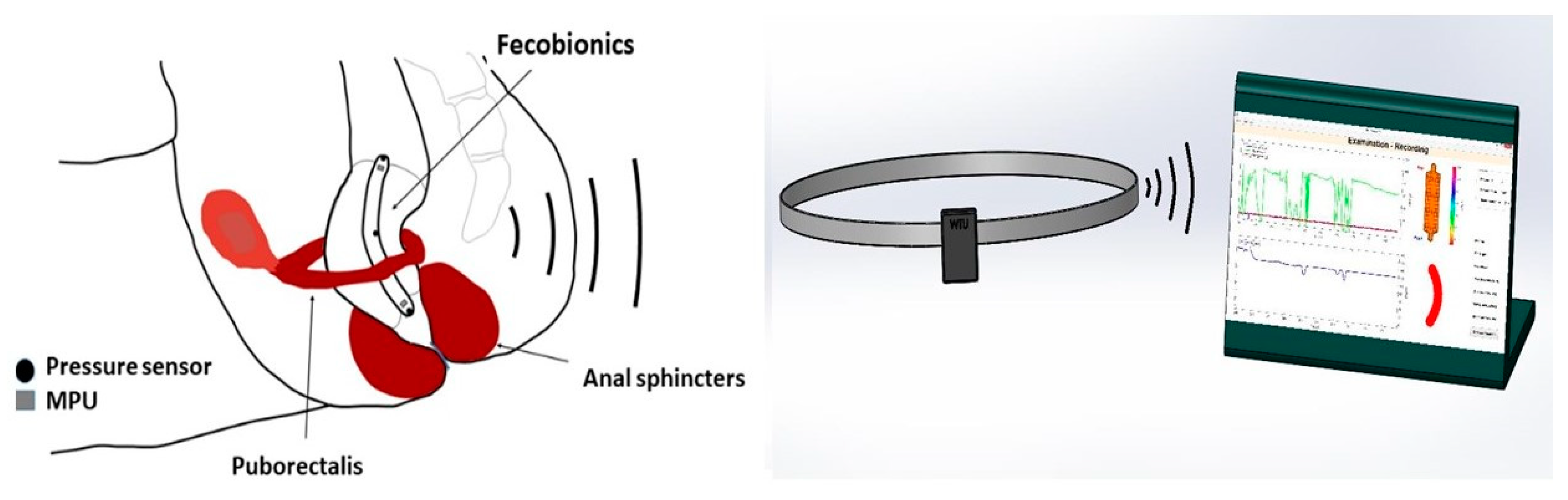 Bioengineering 07 00146 g001 Bioengineering 07 00146 g001