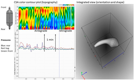 Bioengineering 07 00146 g004 550