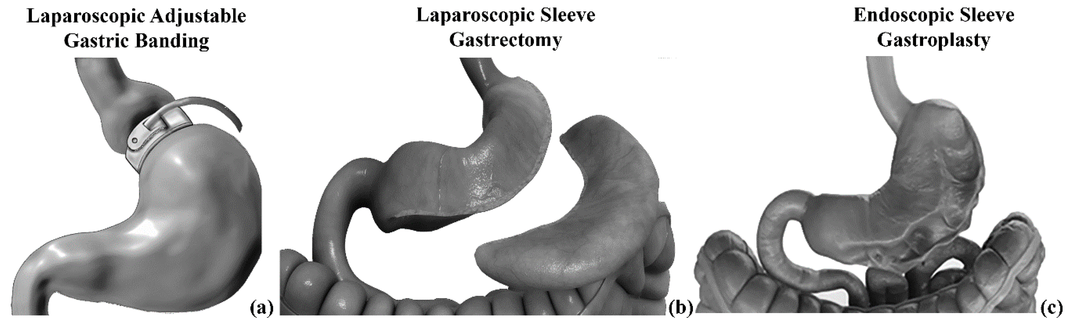 Bioengineering 07 00159 g002