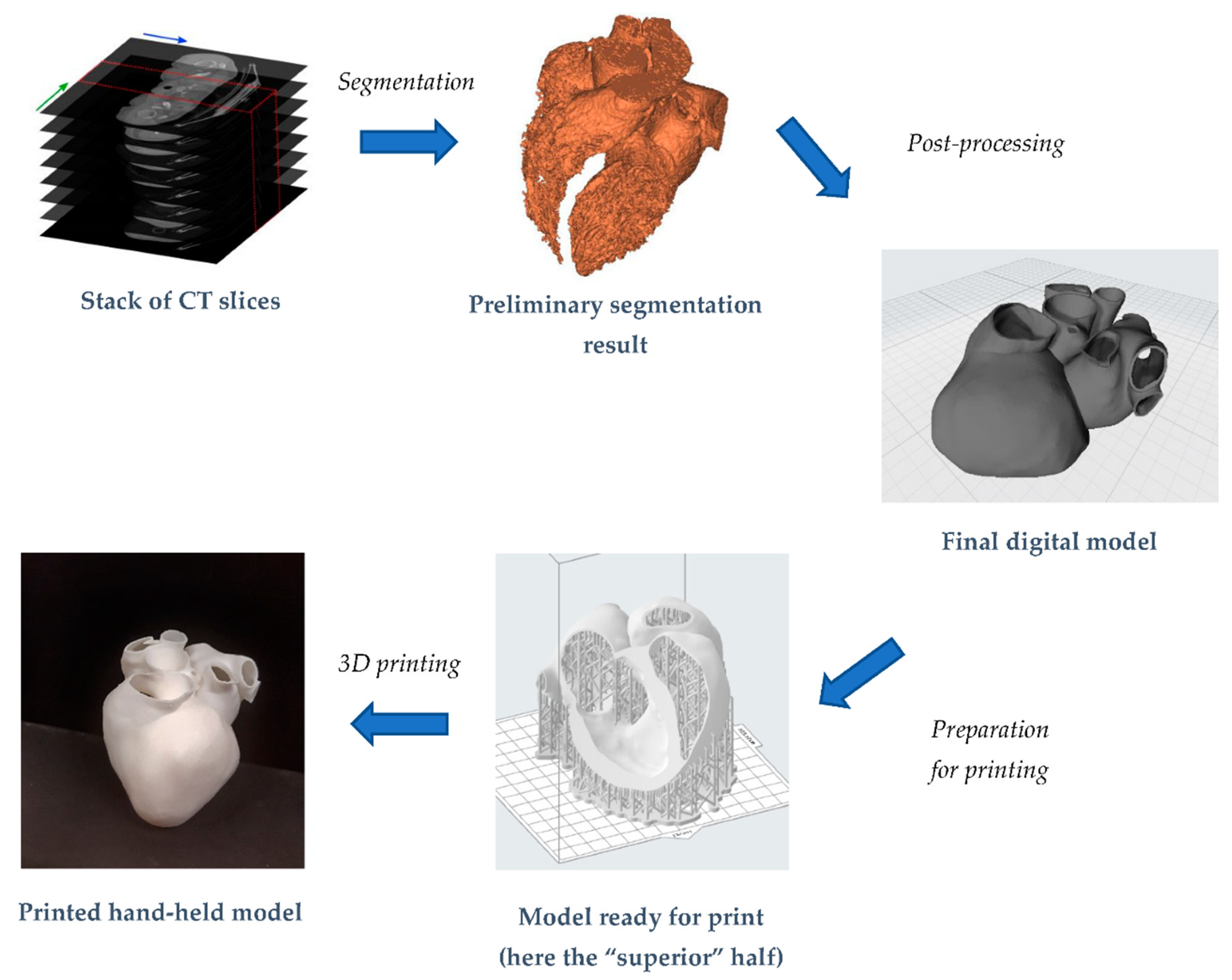 klasselærer Sommerhus Se igennem Bioengineering | Free Full-Text | Operative Workflow from CT to 3D Printing  of the Heart: Opportunities and Challenges