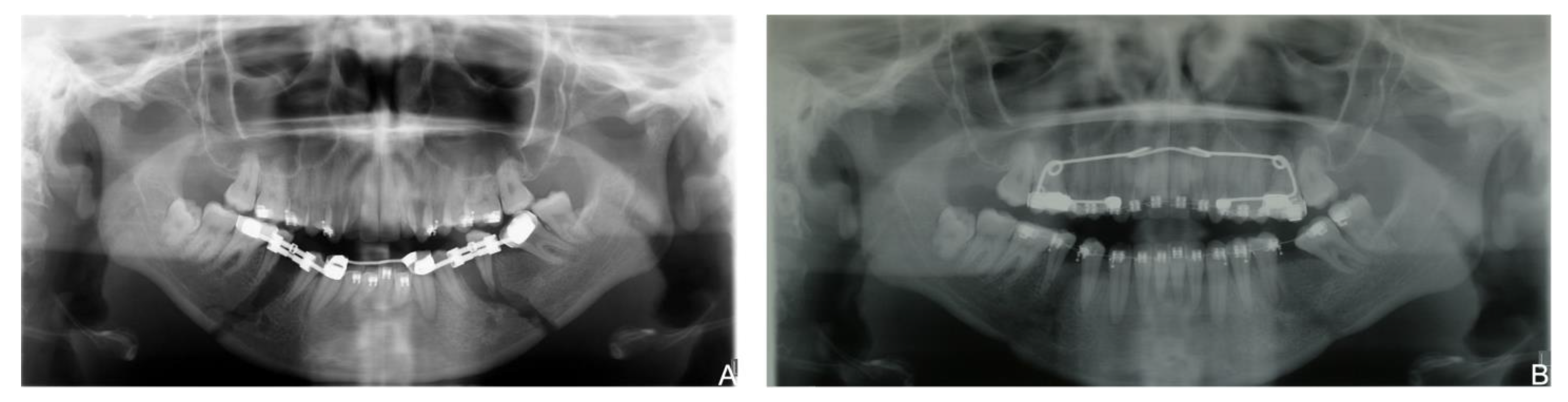 Bioengineering 08 00180 g005